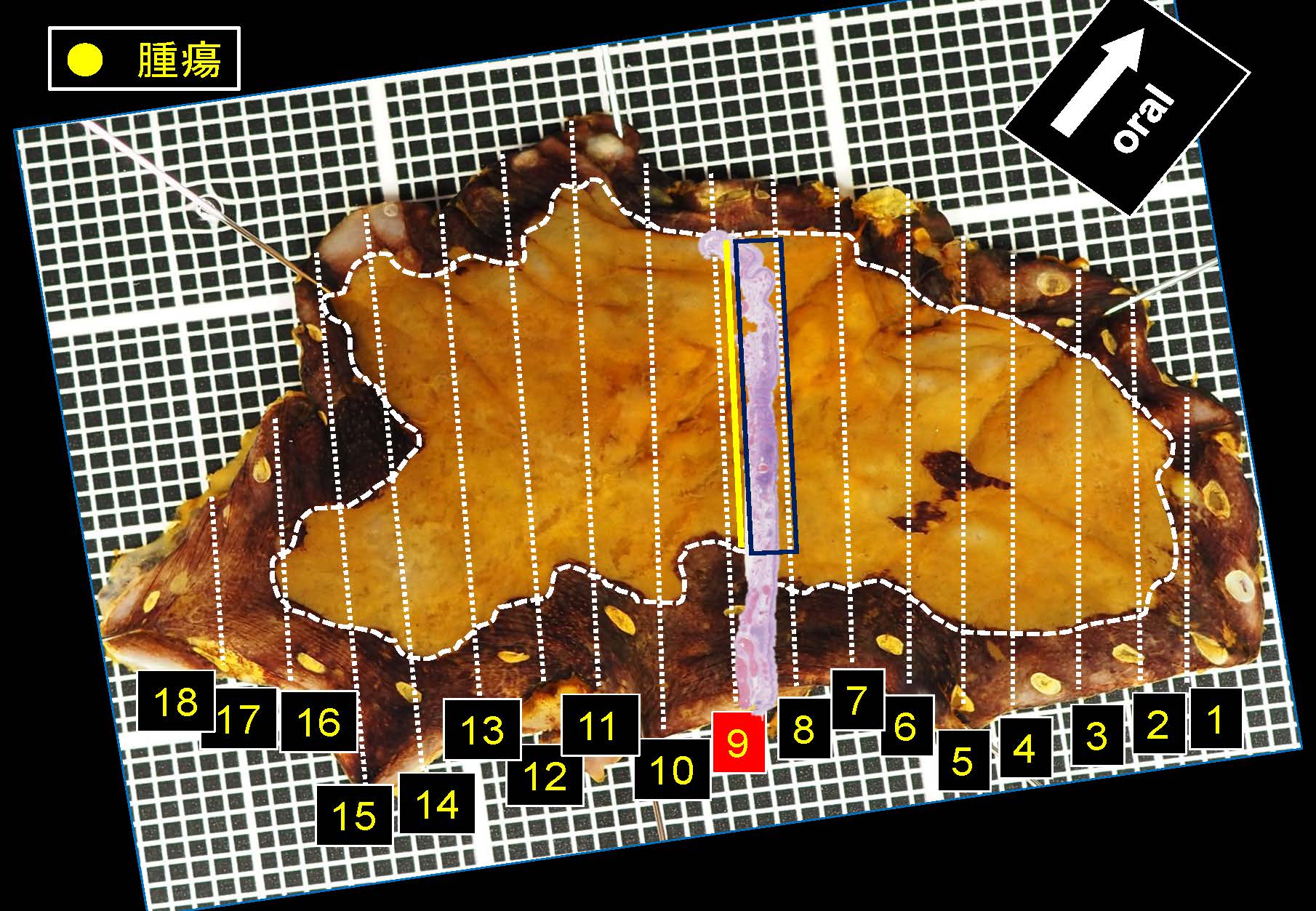 食道044