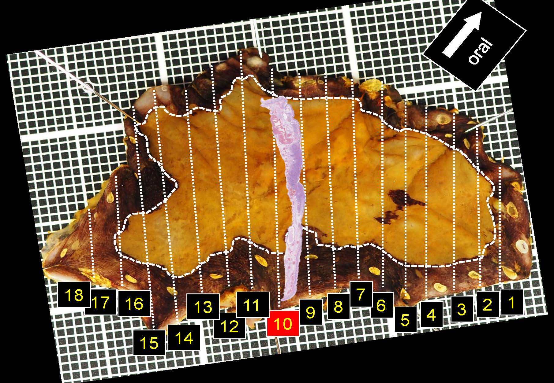 食道049