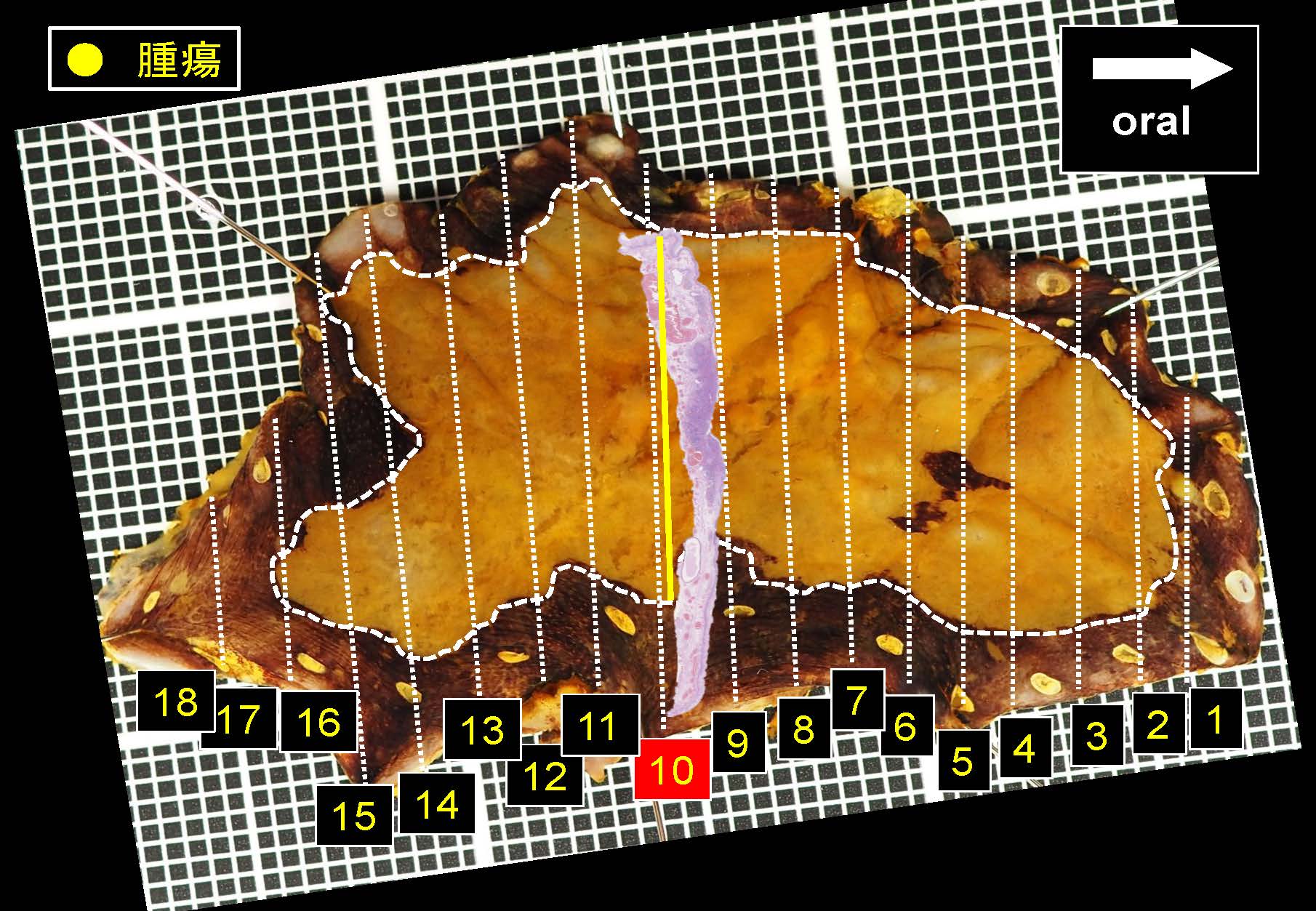 食道050