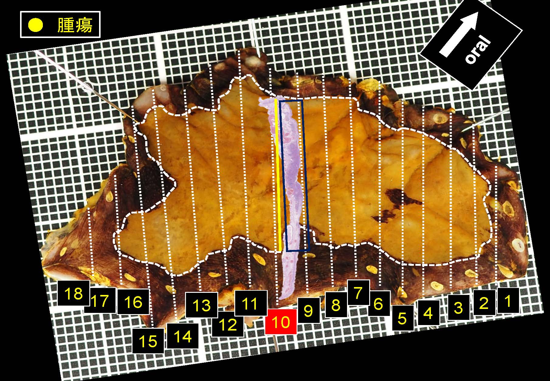 食道051