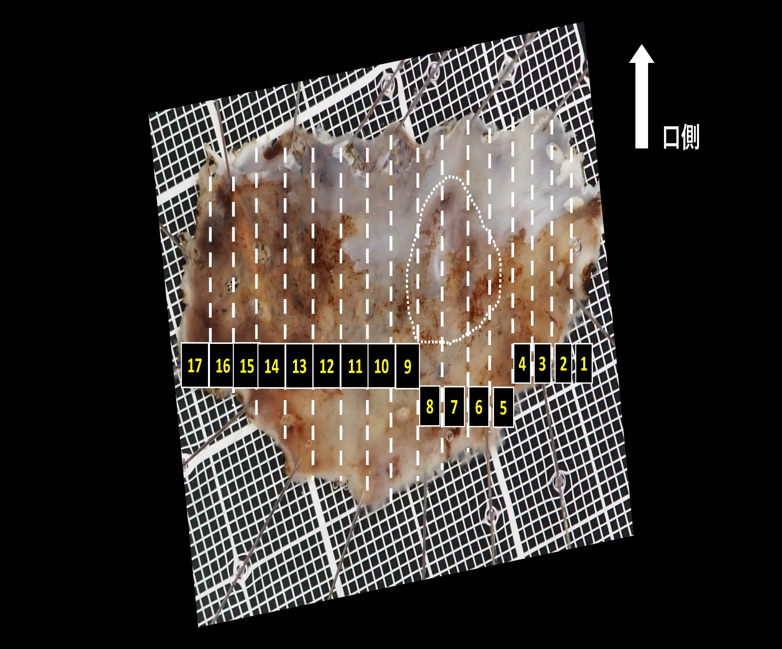 食道027