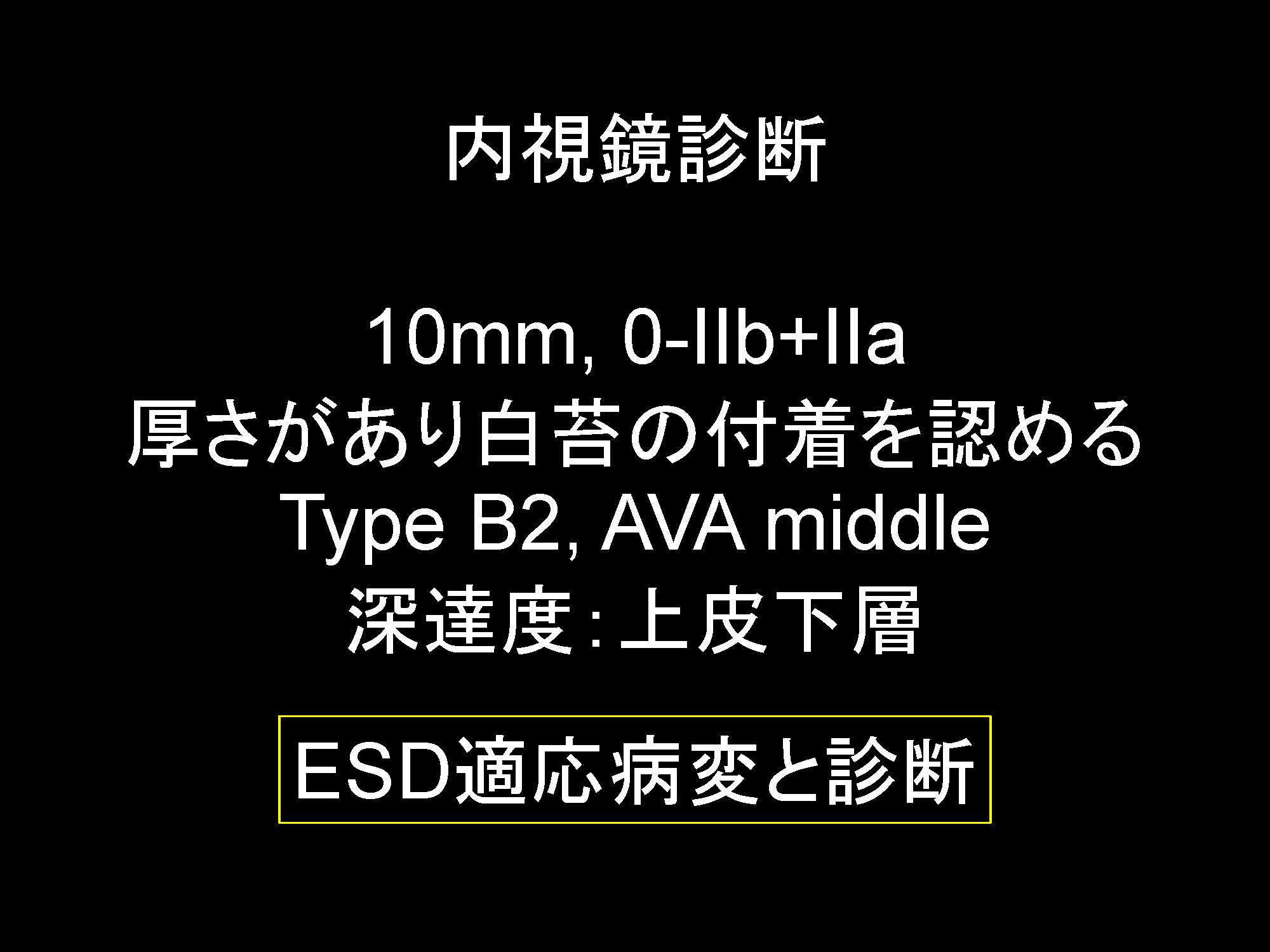 咽頭014