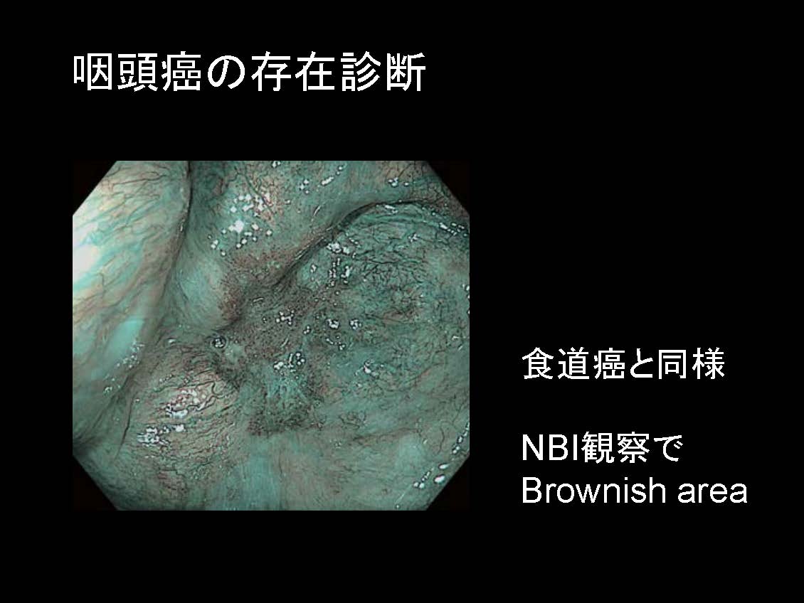 咽頭063