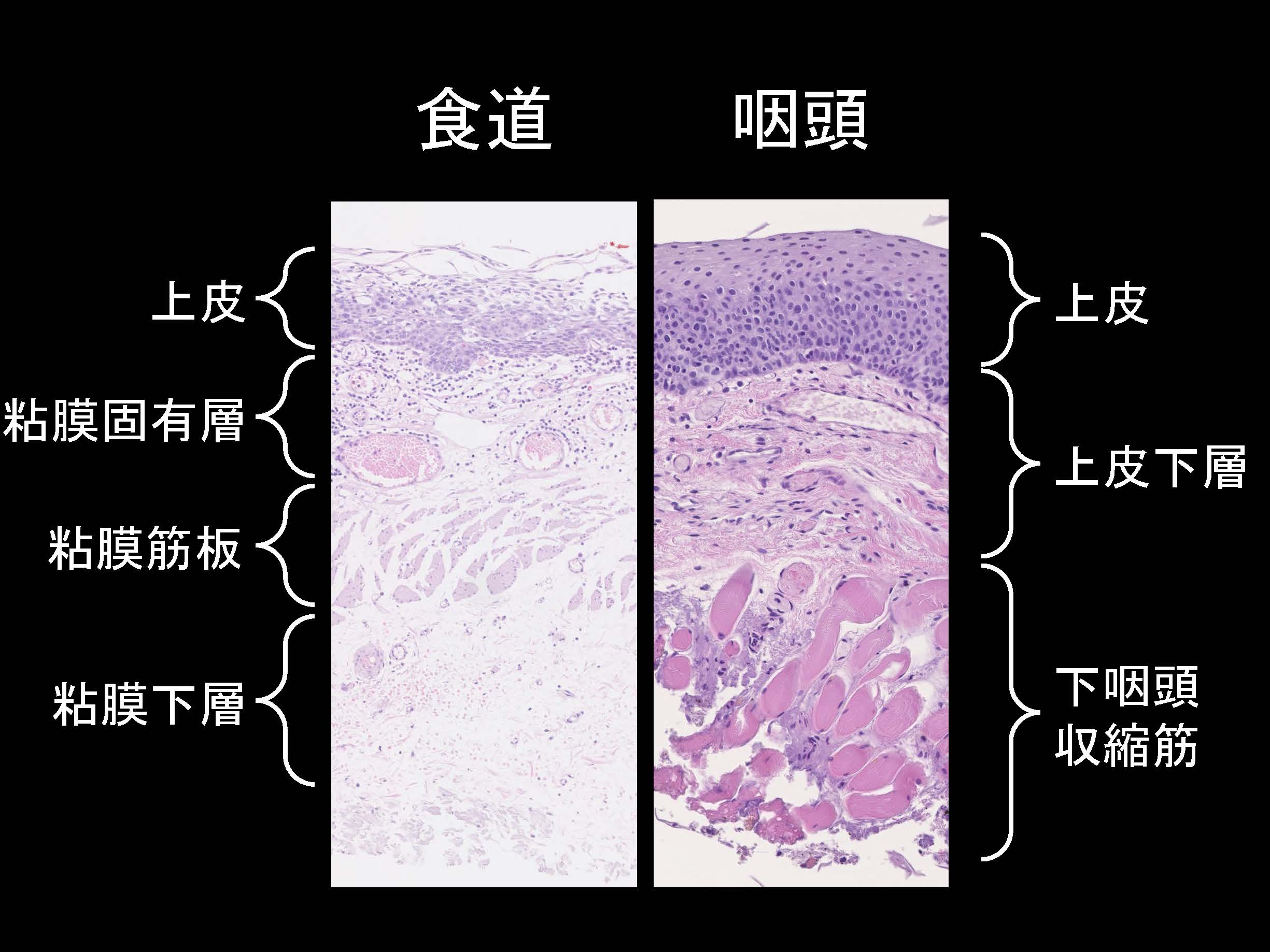 咽頭064