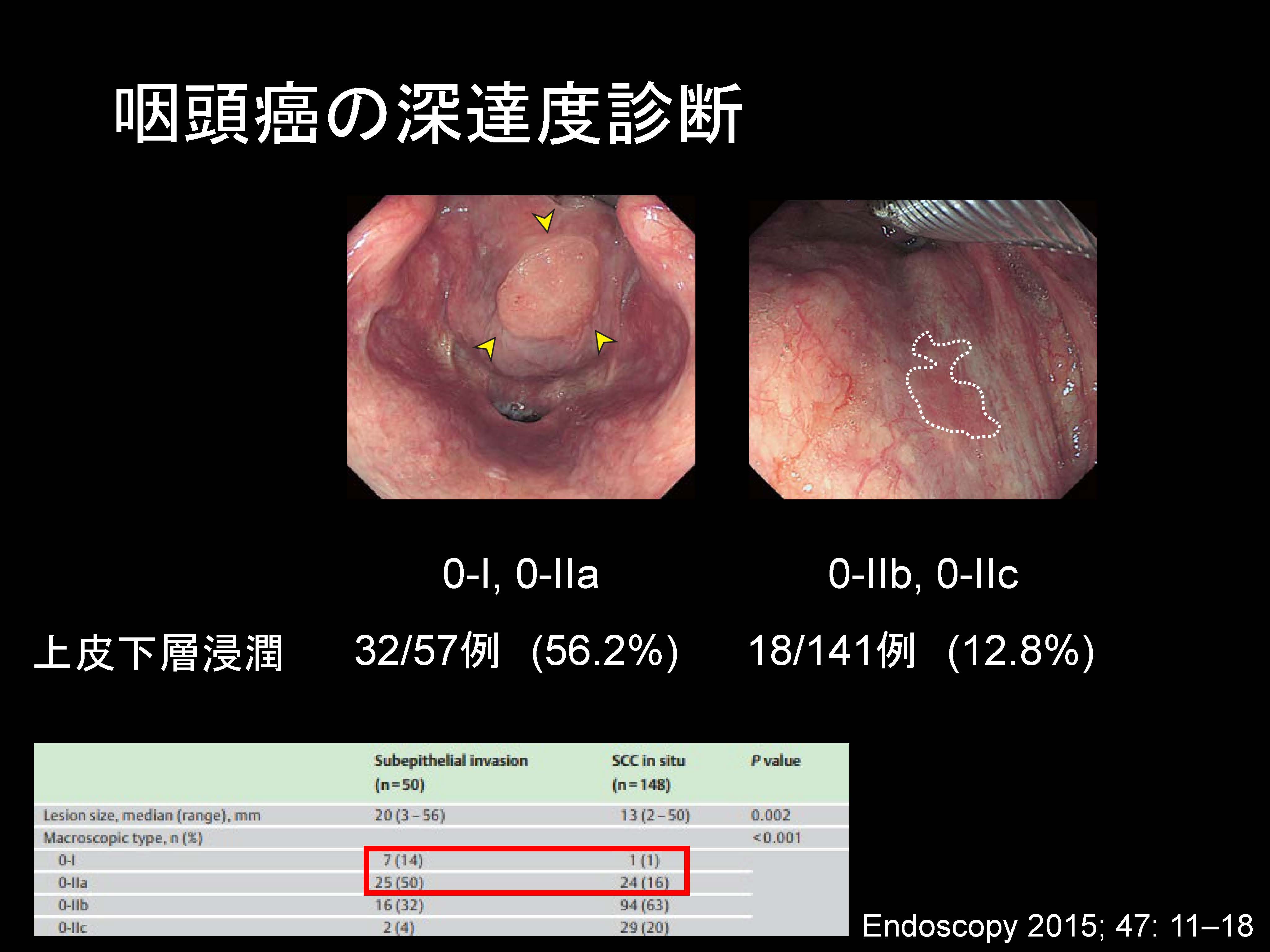 咽頭065