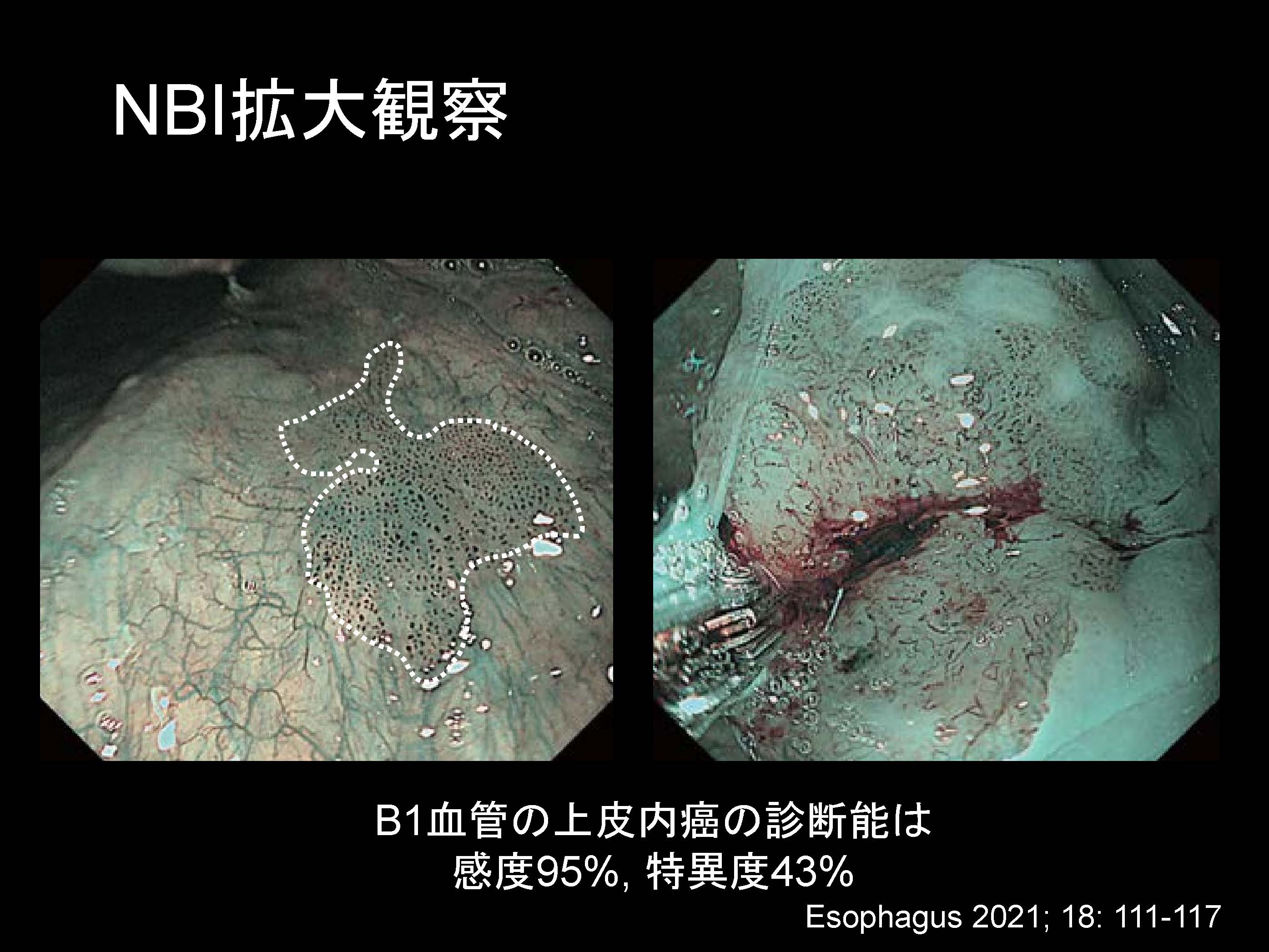 咽頭068
