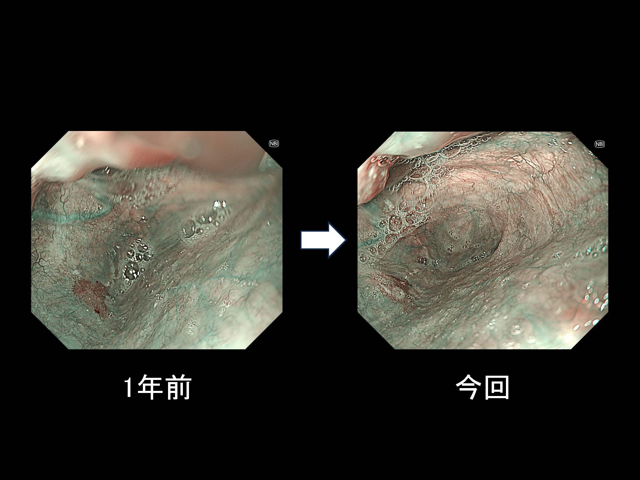 咽頭074