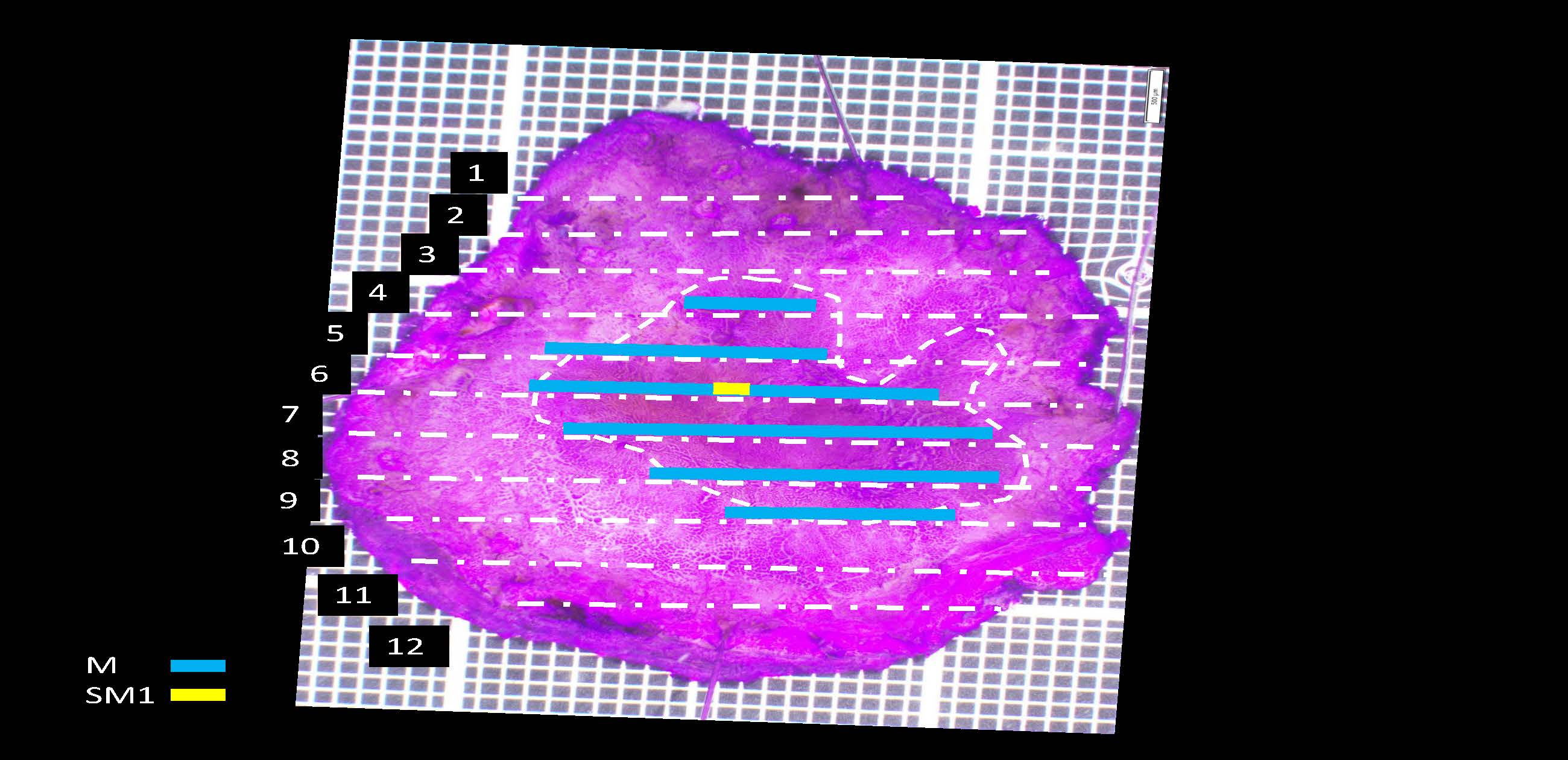 胃076