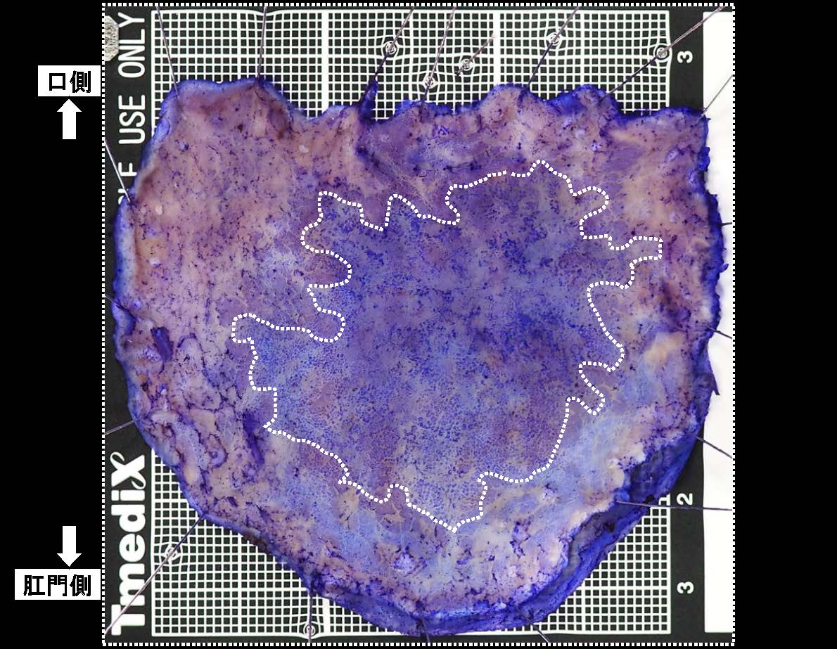 胃040