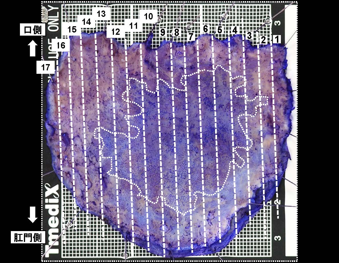 胃052