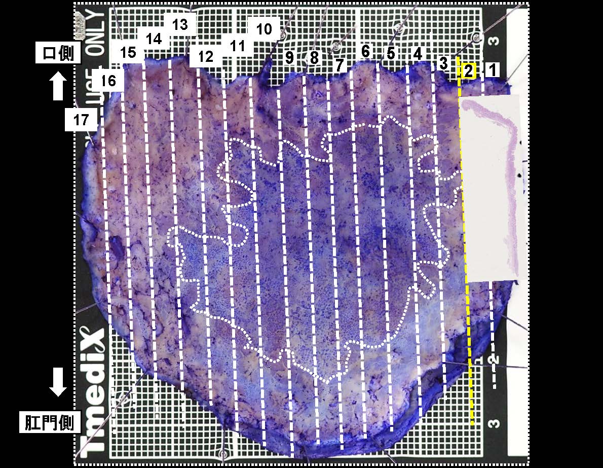 胃056
