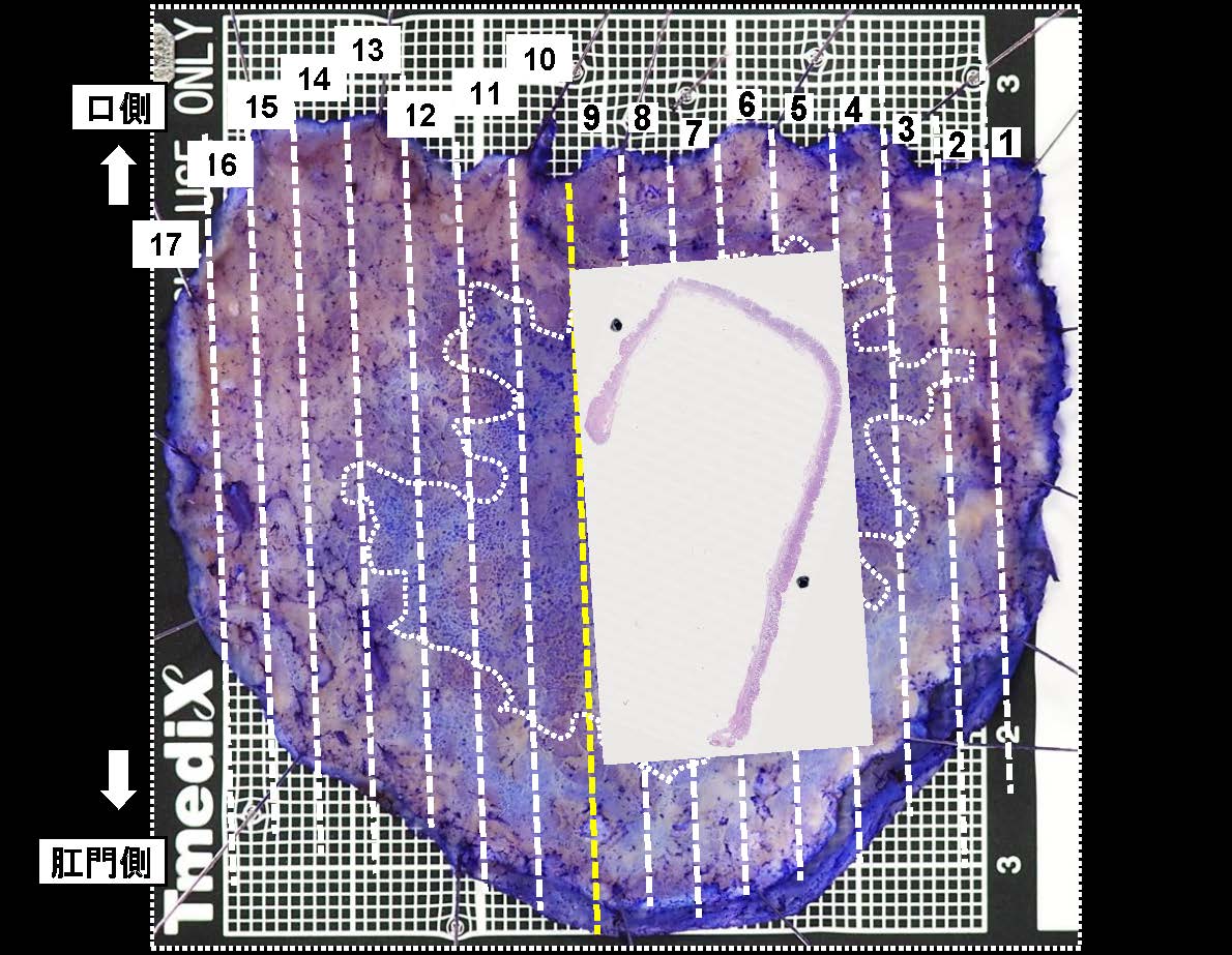 胃074