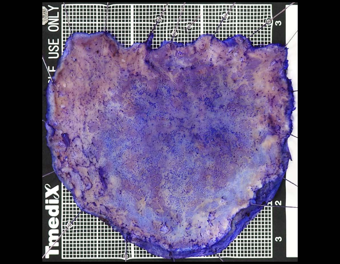 胃092