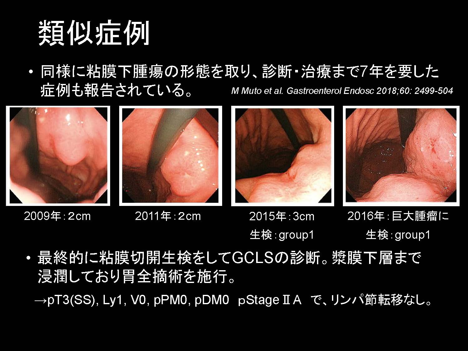 胃061