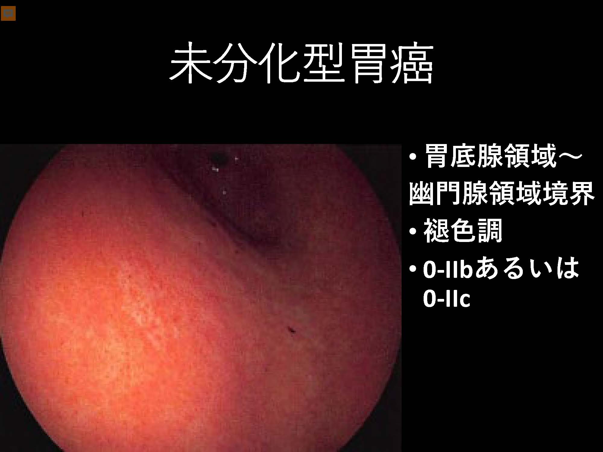 胃081