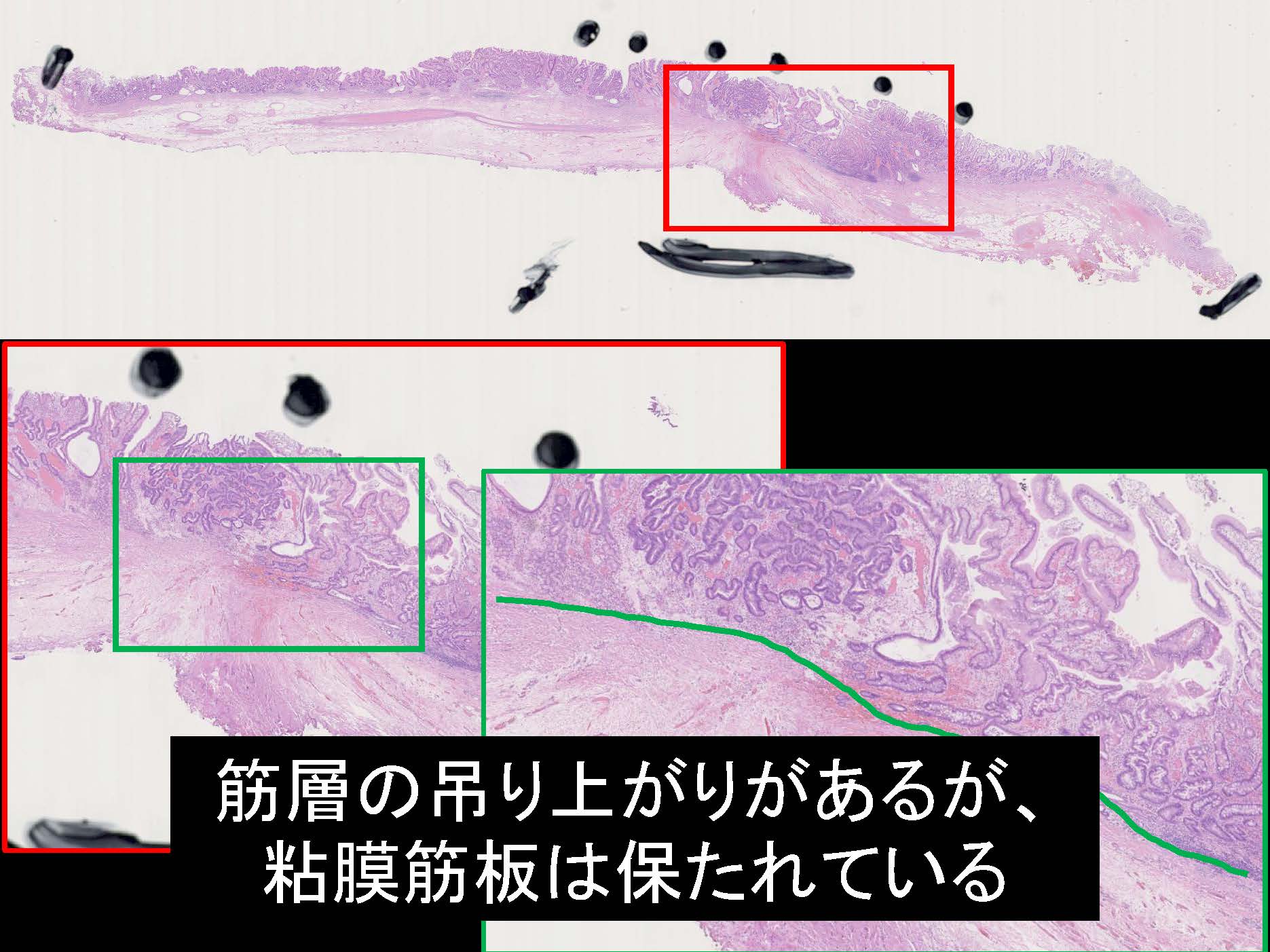 胃120