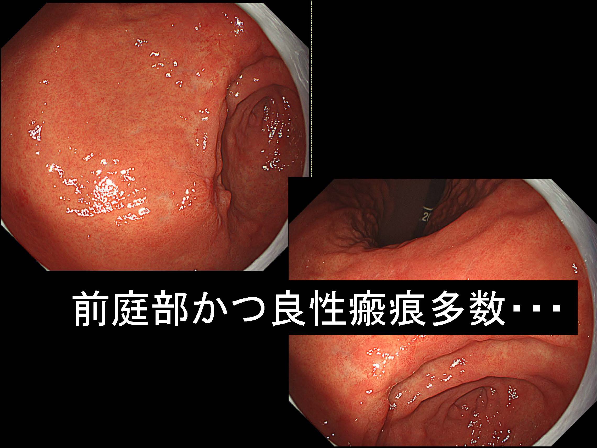 胃122