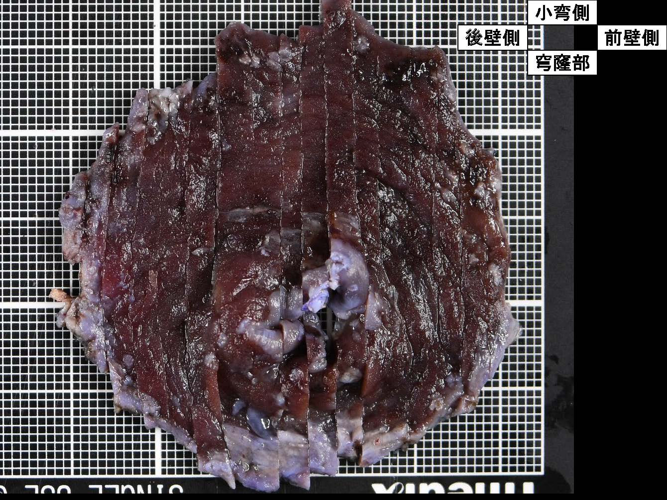 胃041