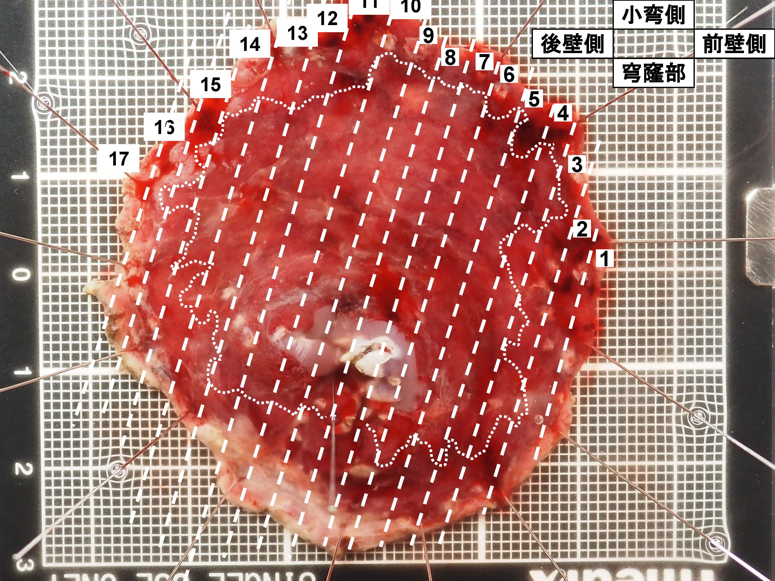 胃045