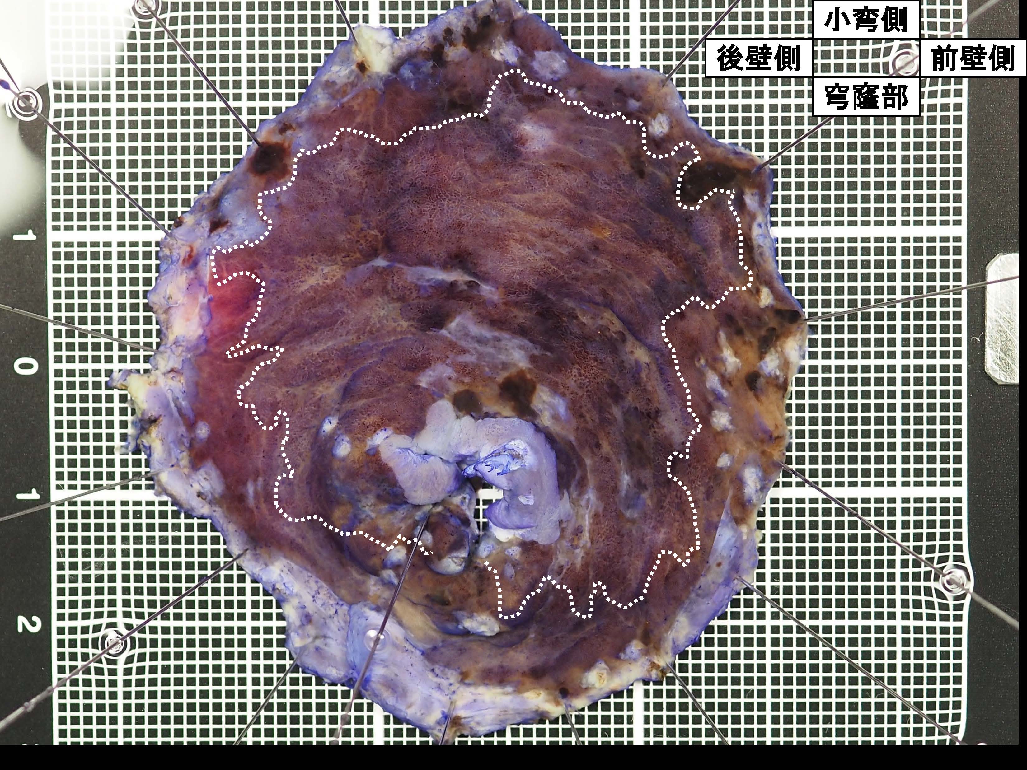 胃050