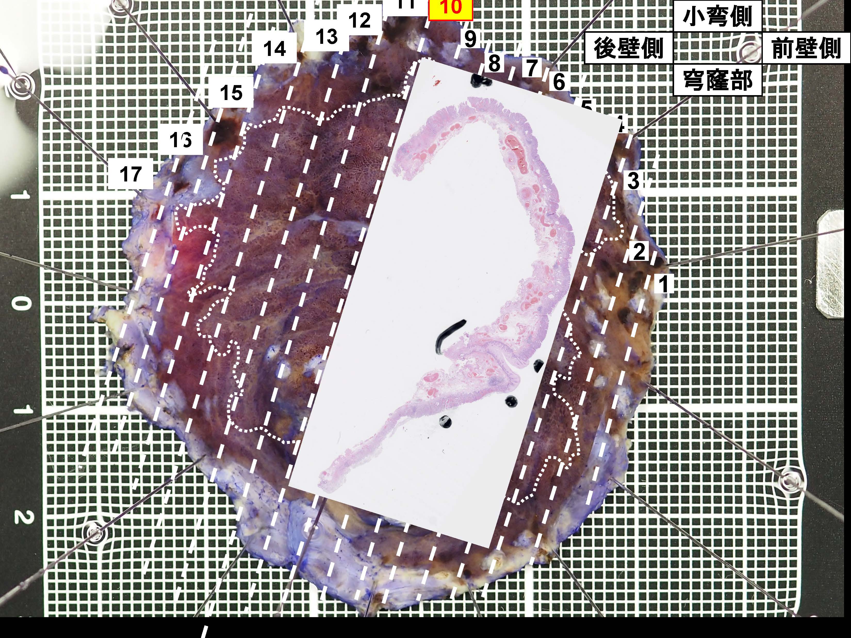 胃054