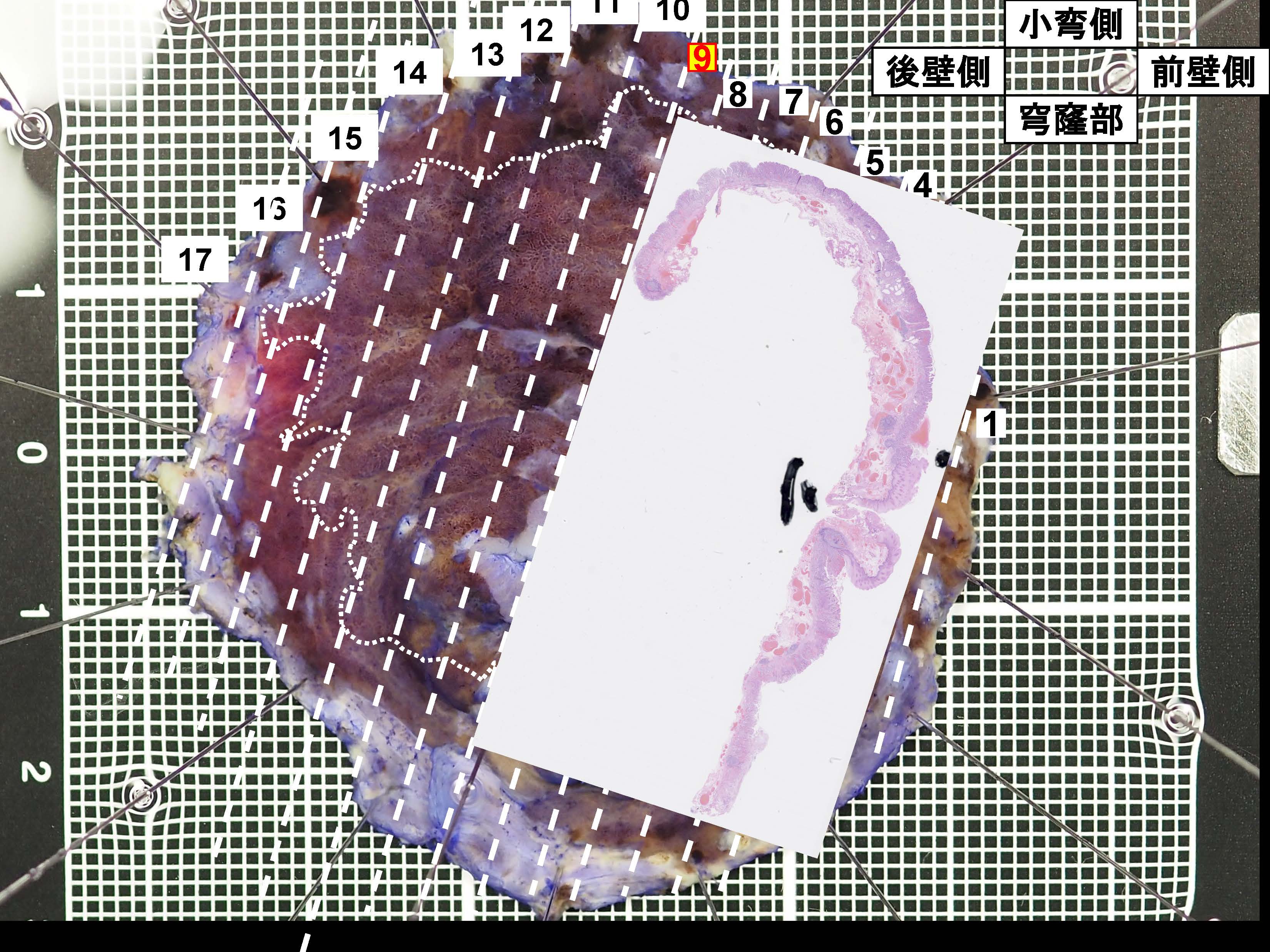 胃063