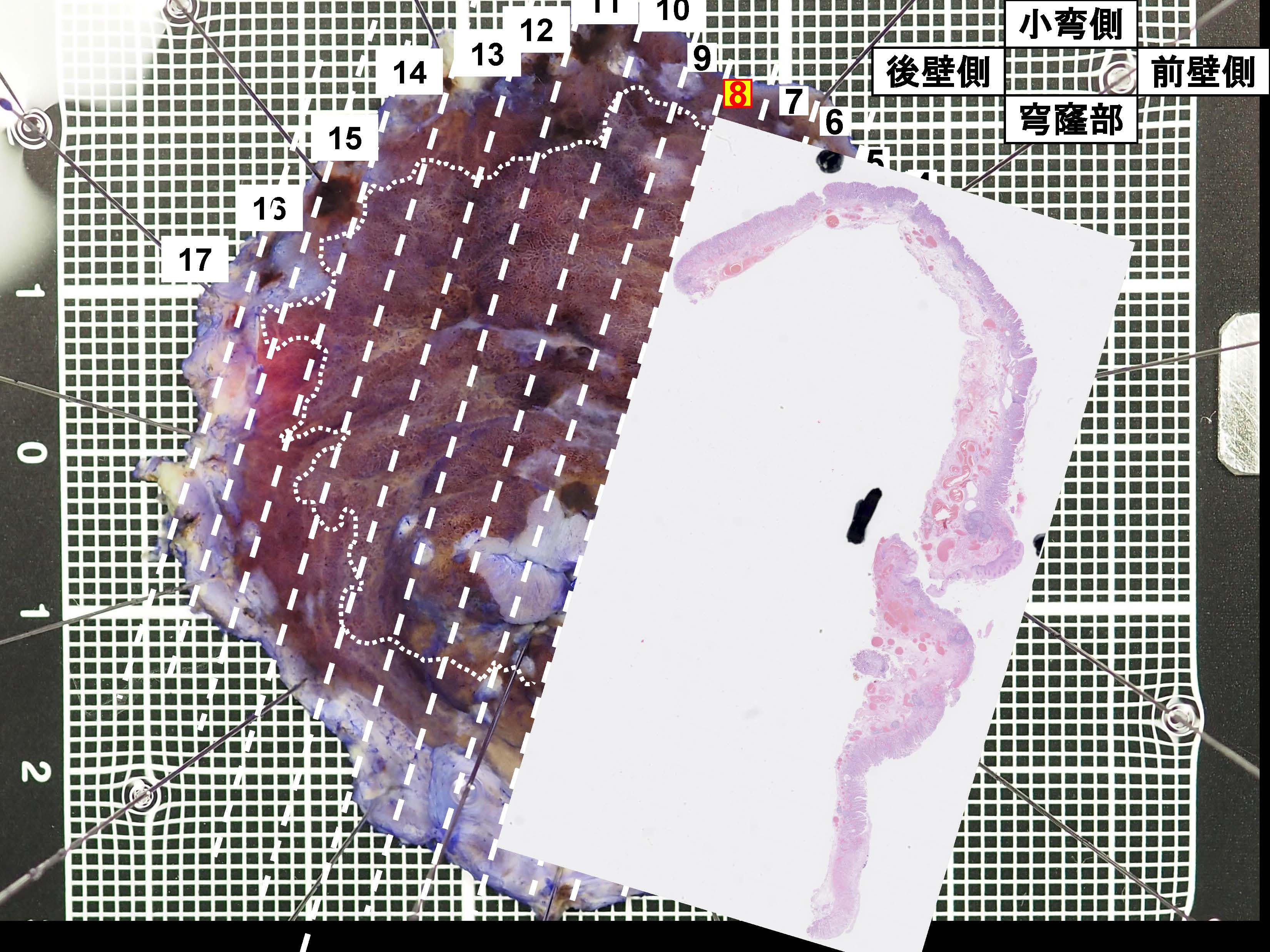 胃069