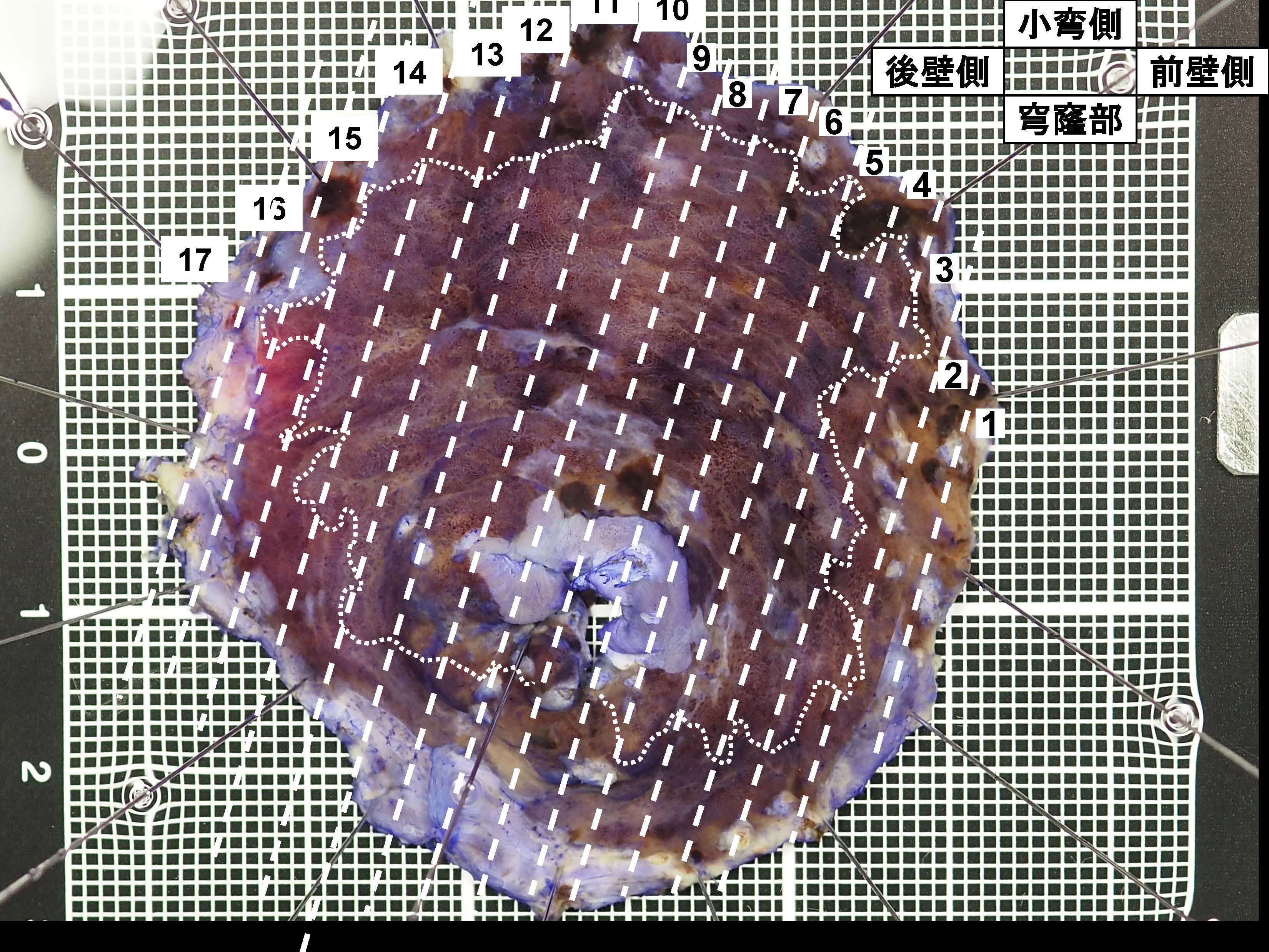 胃076