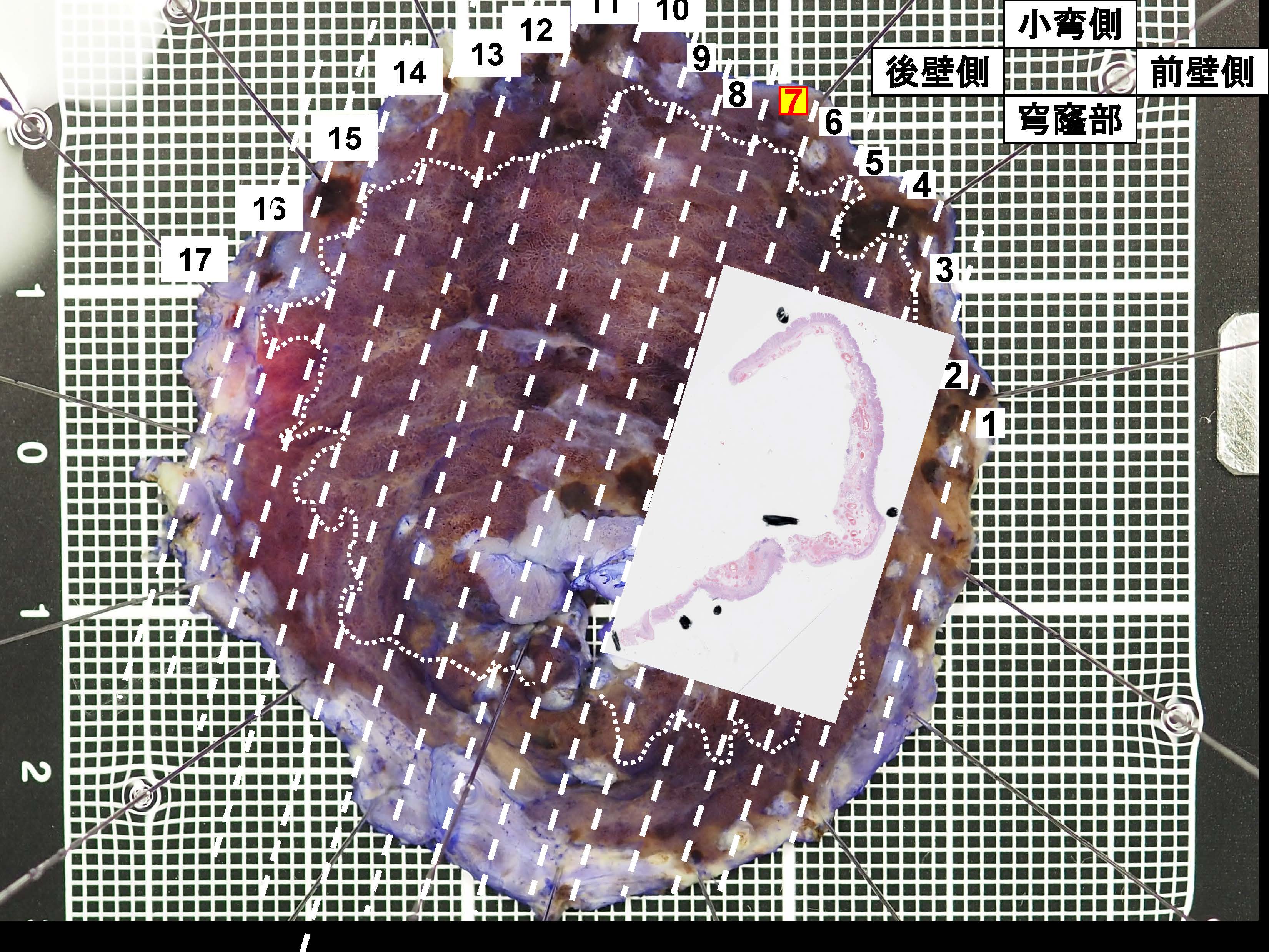 胃077