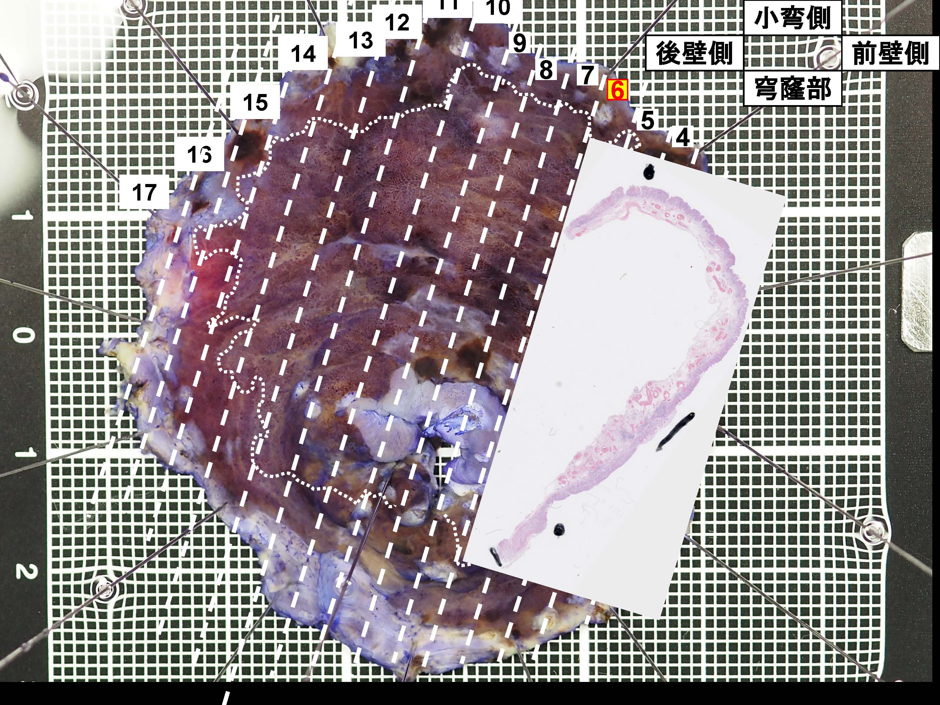 胃086