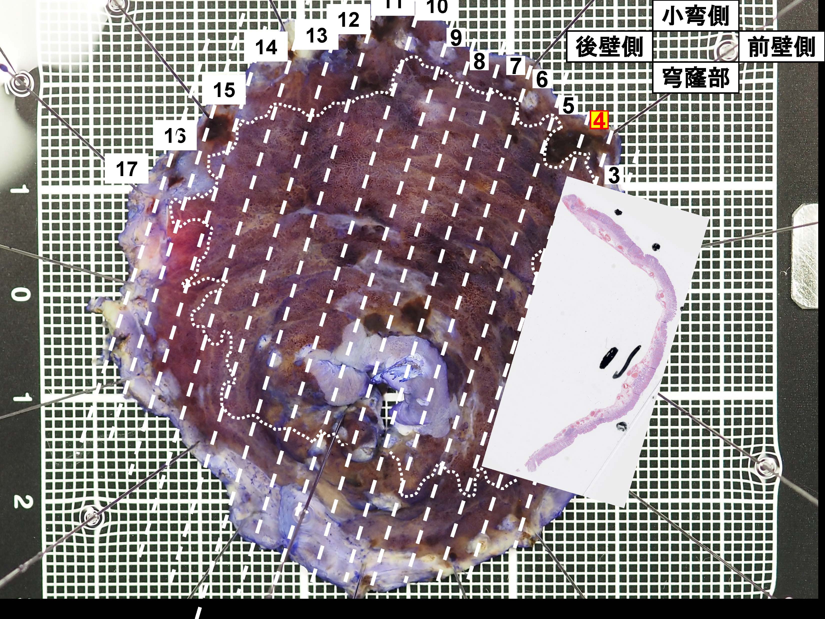 胃094
