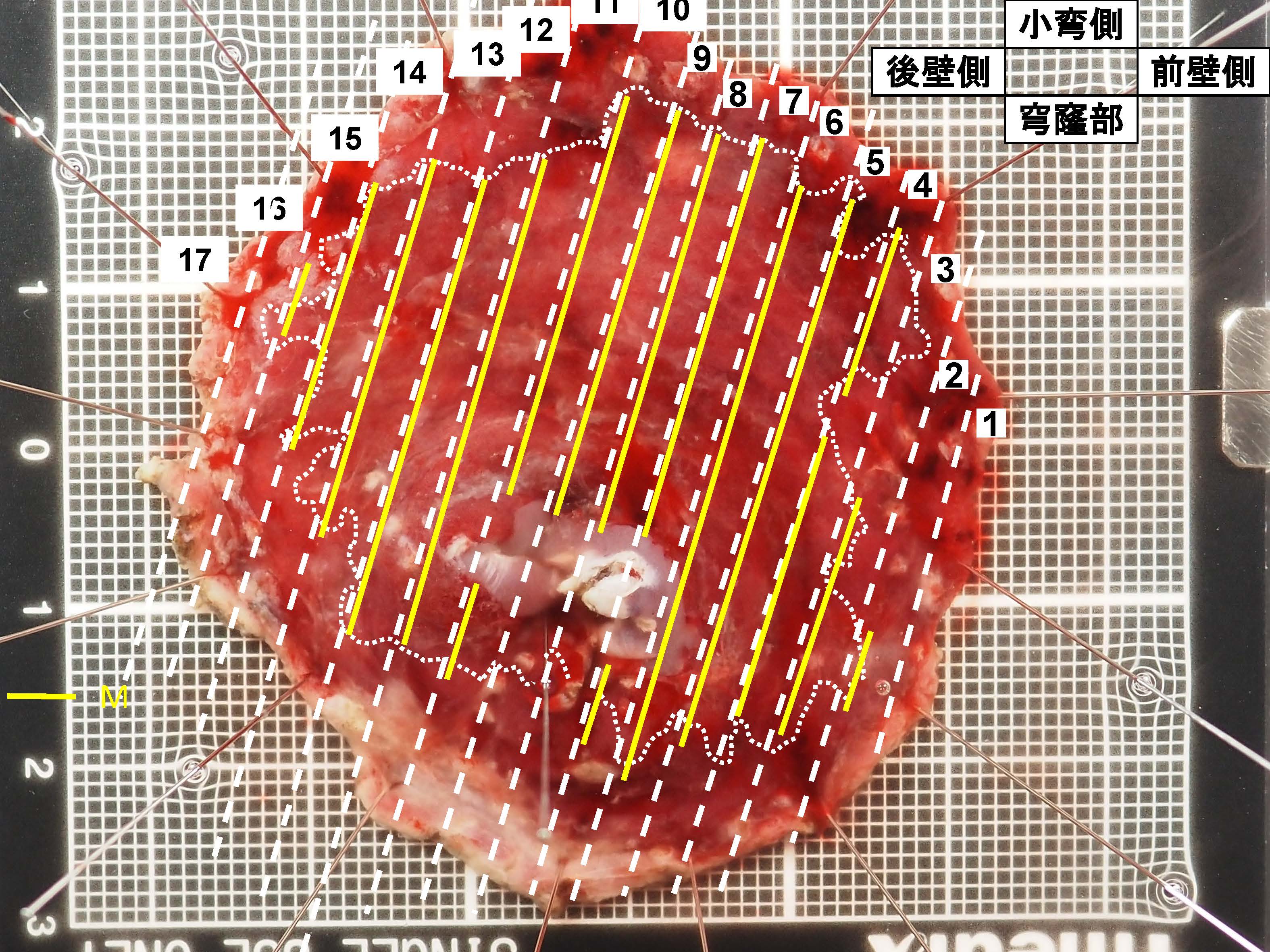 胃106