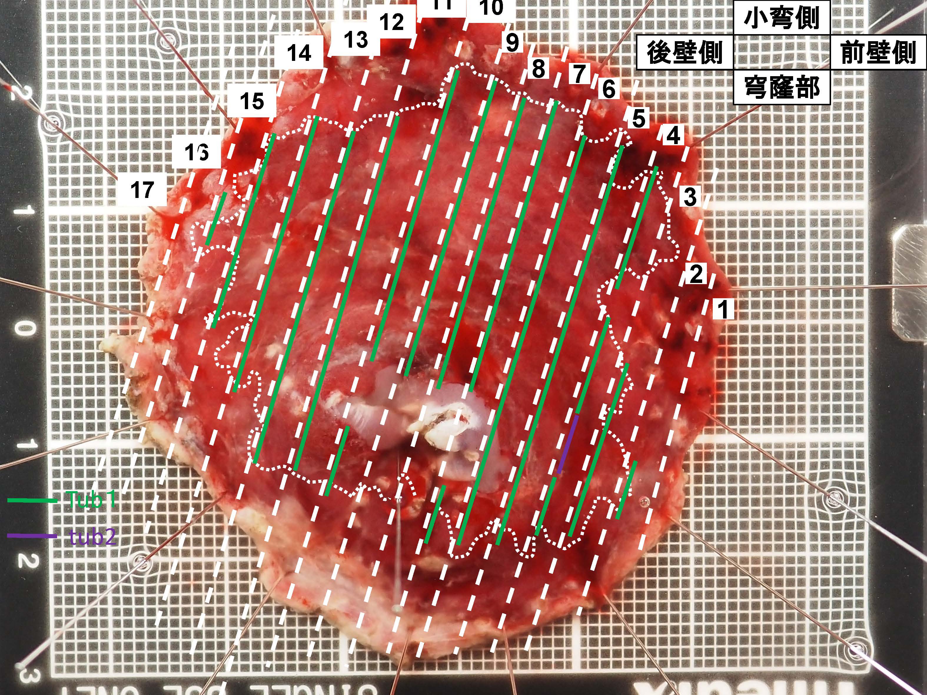 胃107