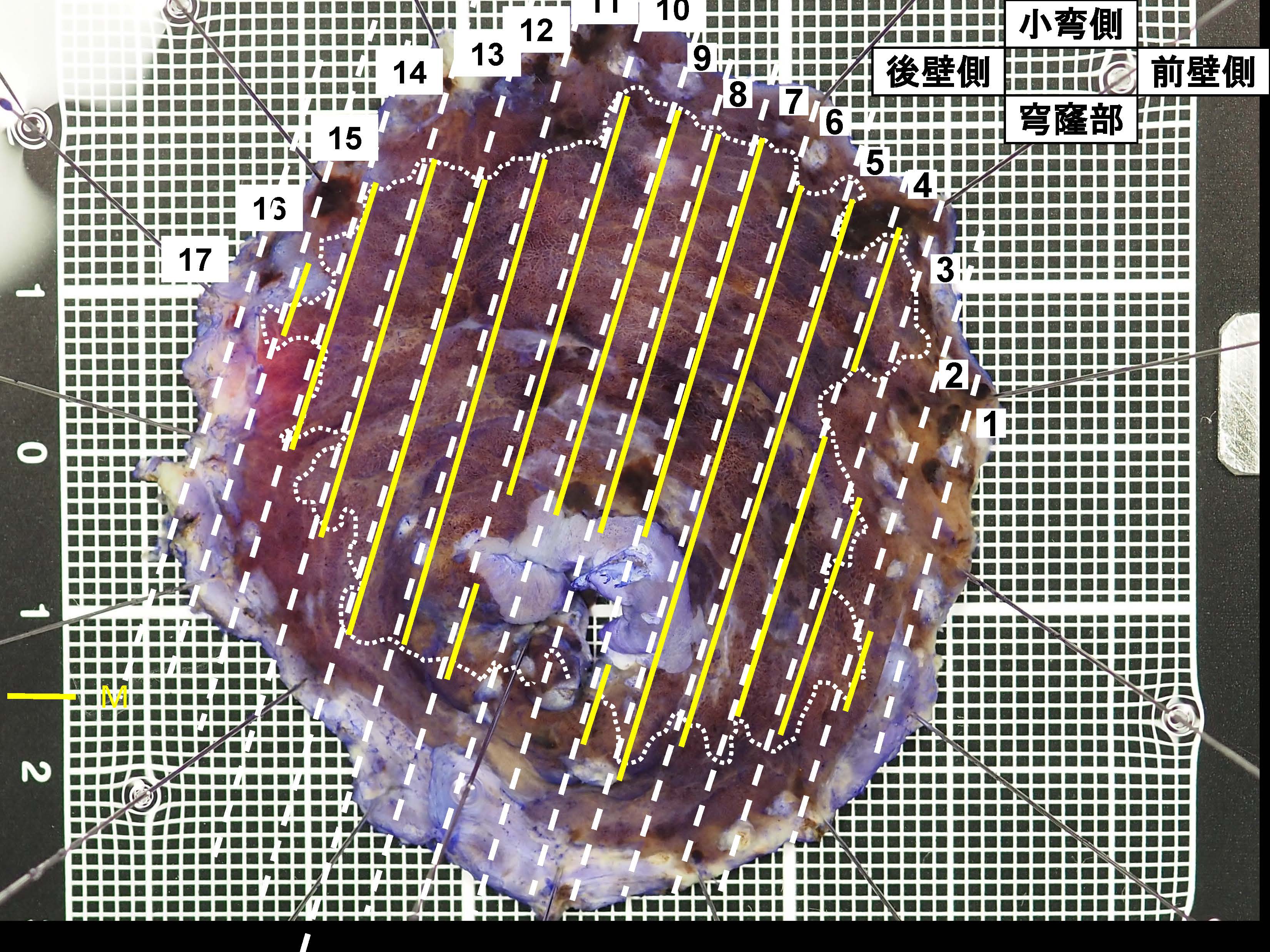 胃117
