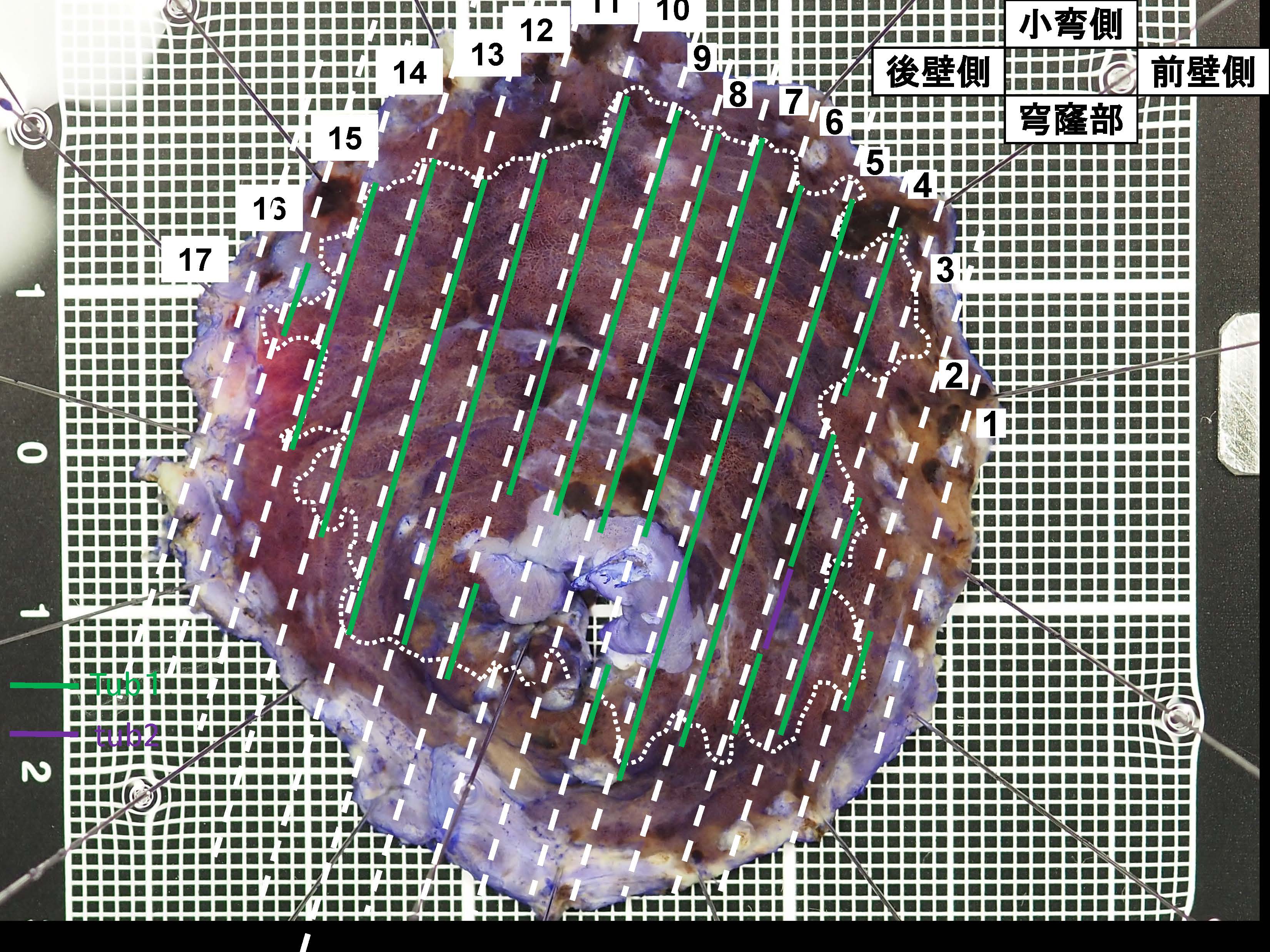 胃119