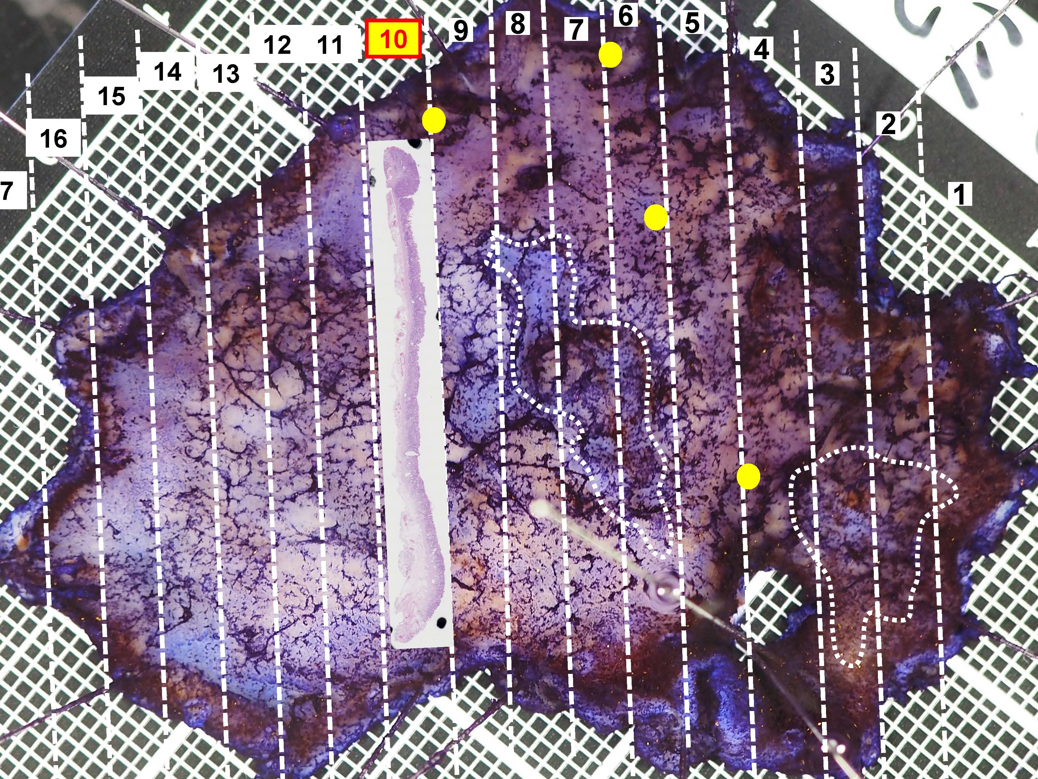 胃096