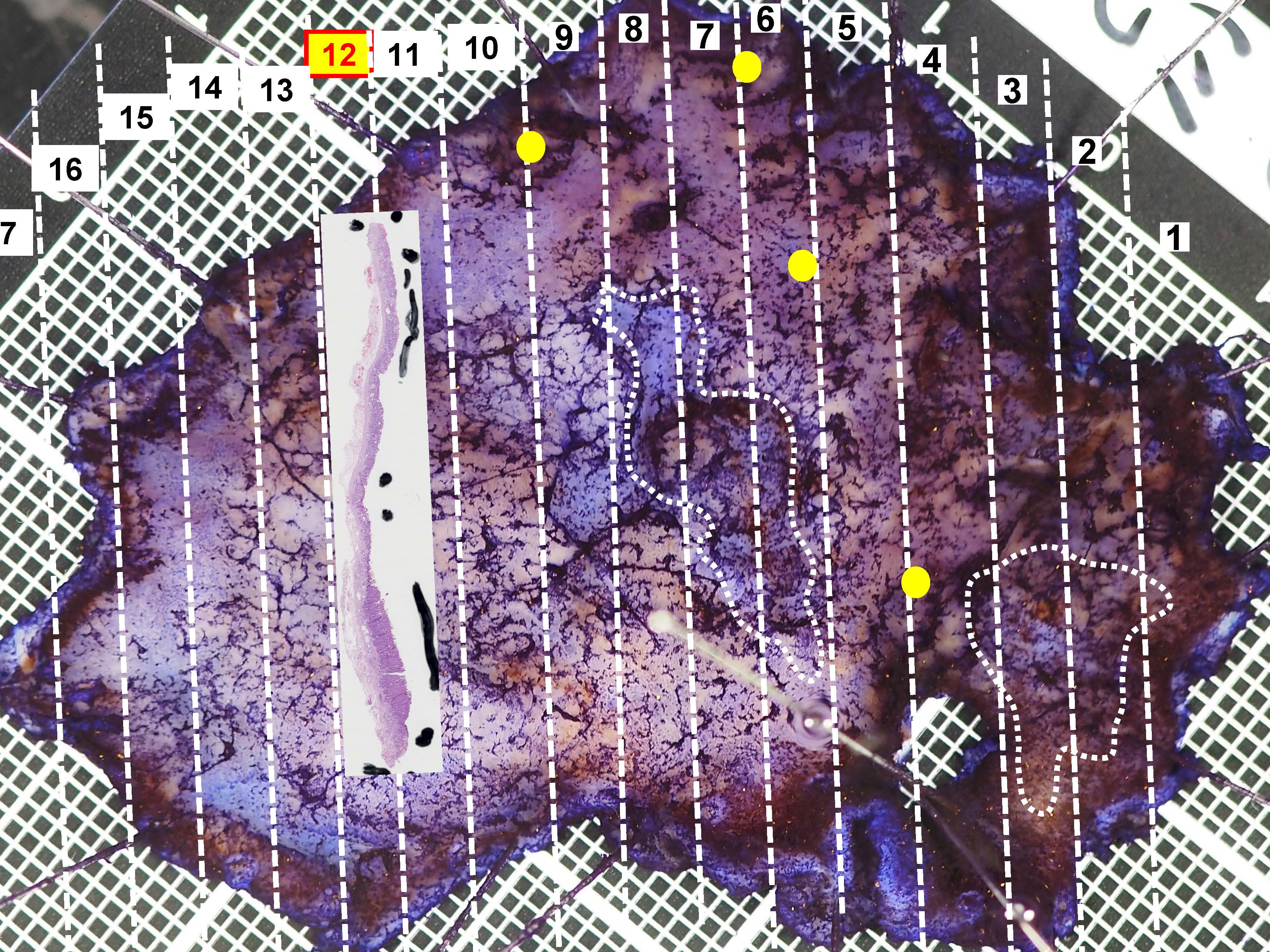 胃112