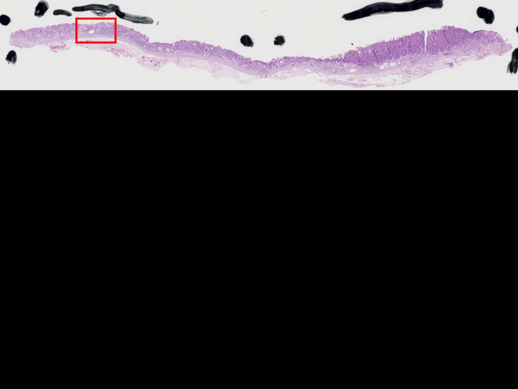 胃113