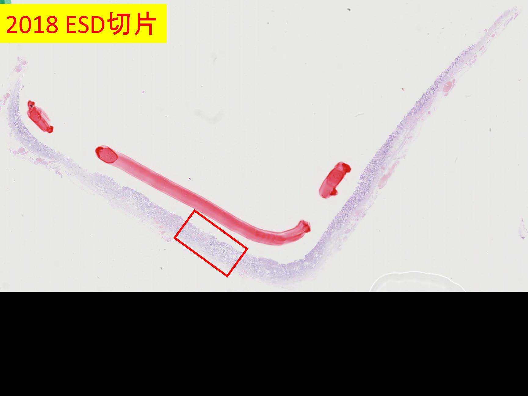 胃150