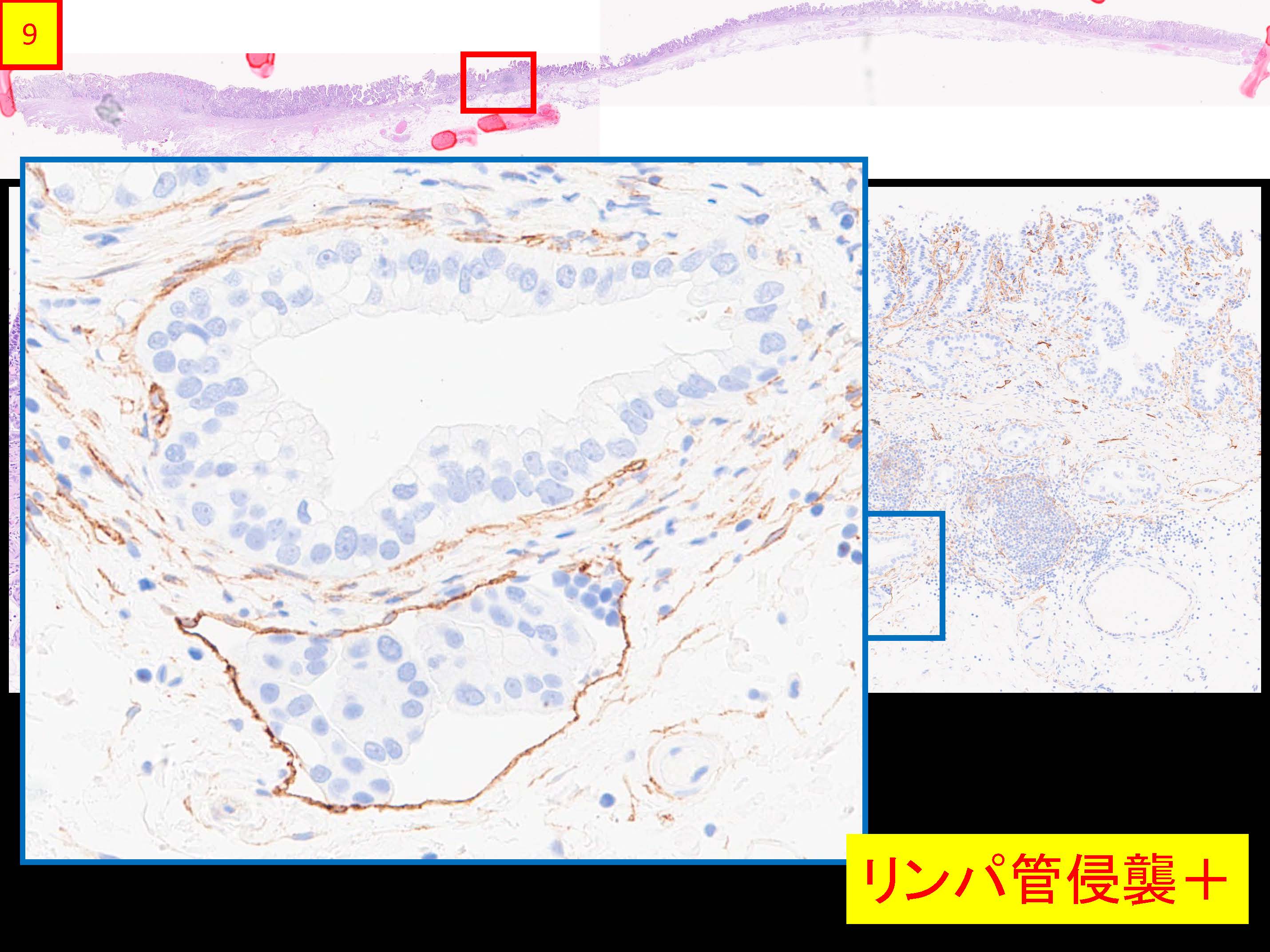 胃068
