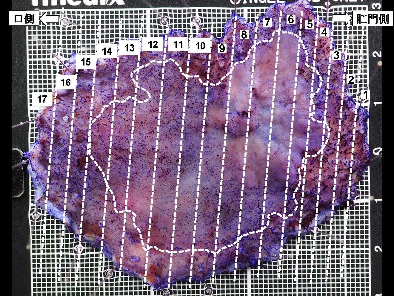 胃104