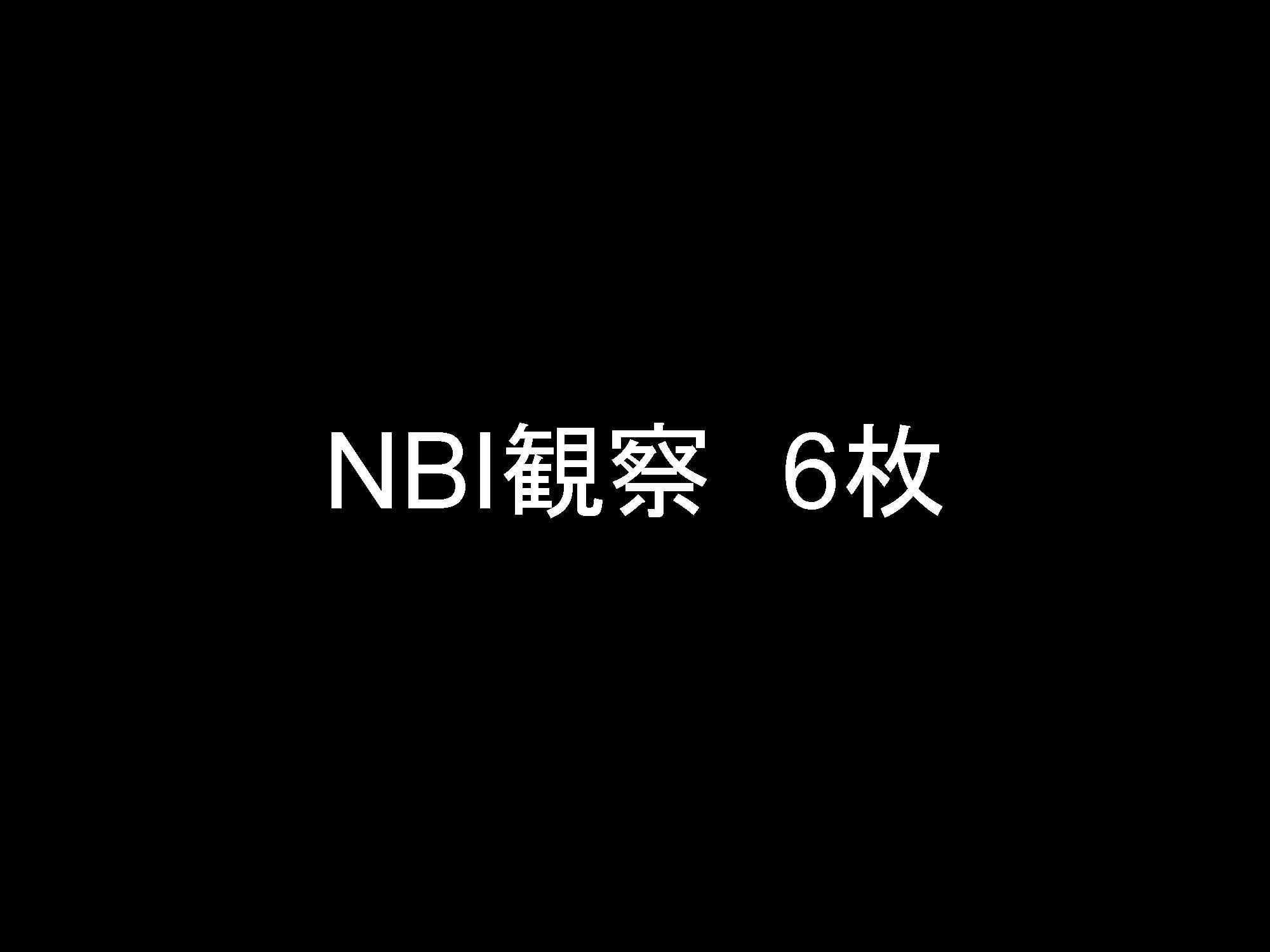 胃009