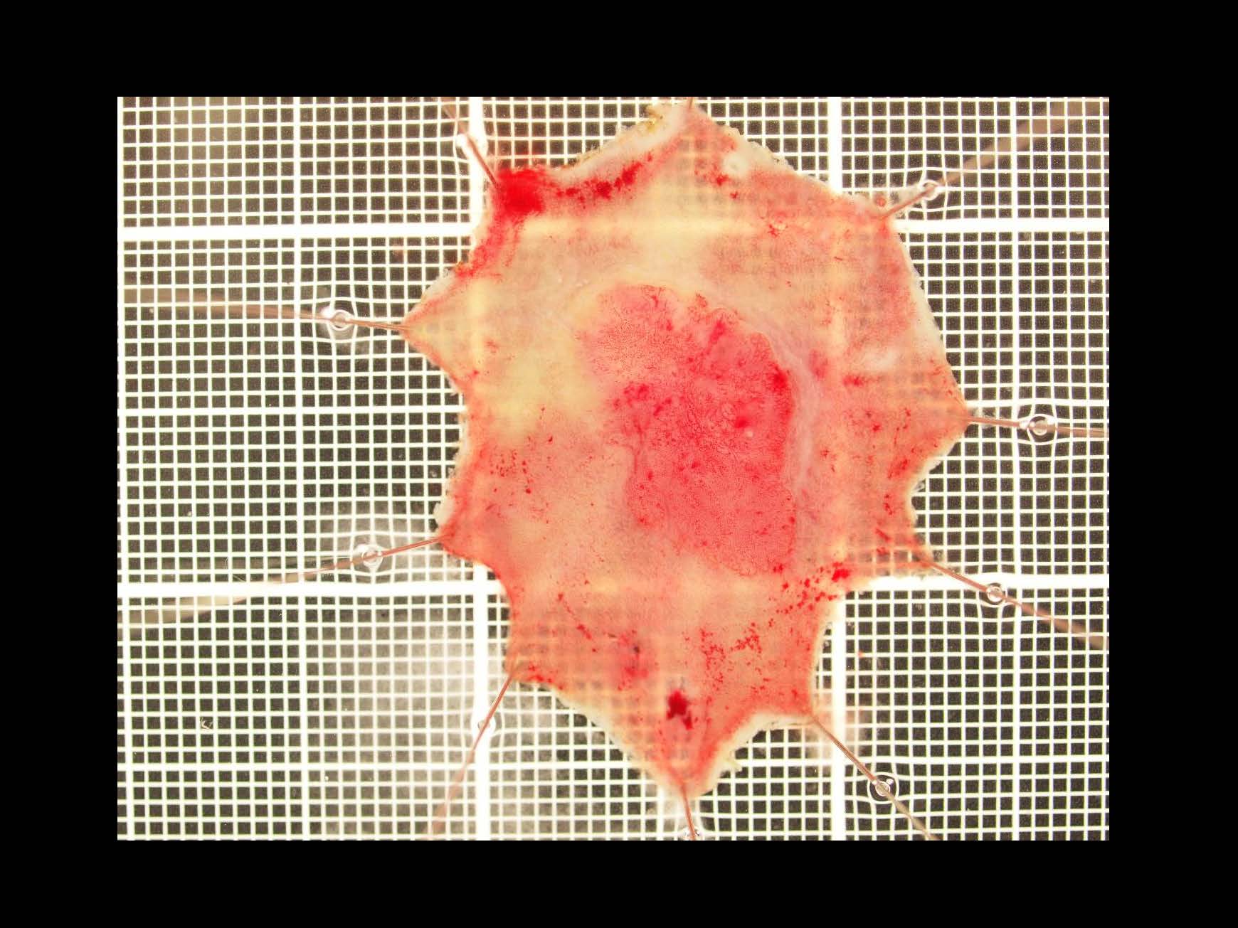 大腸031