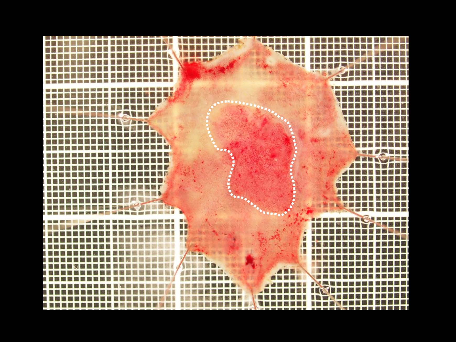 大腸032