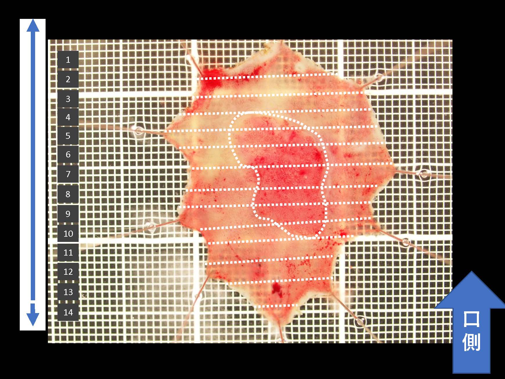 大腸033