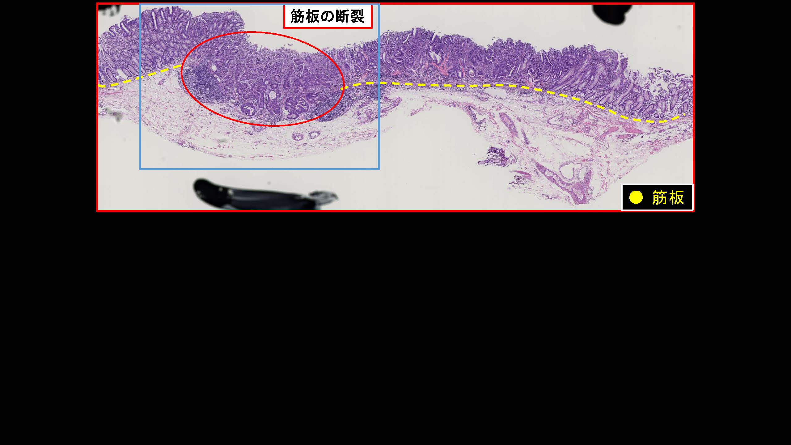 大腸048