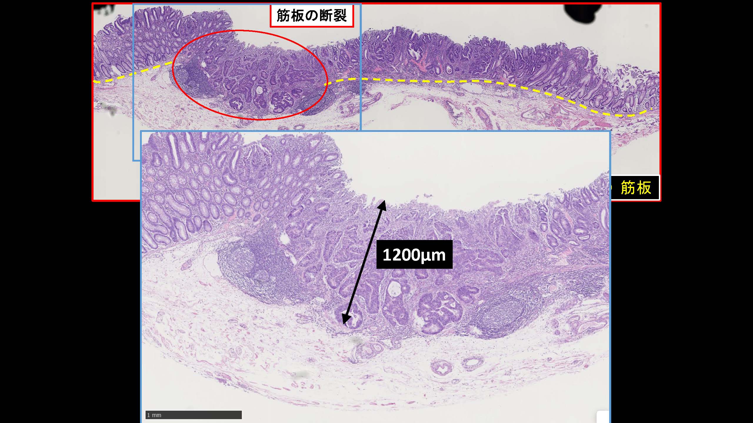 大腸050