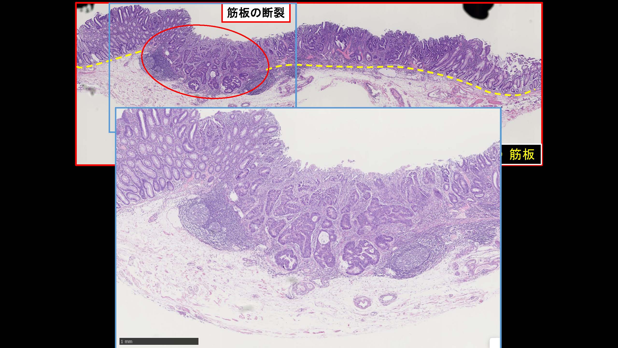 大腸051