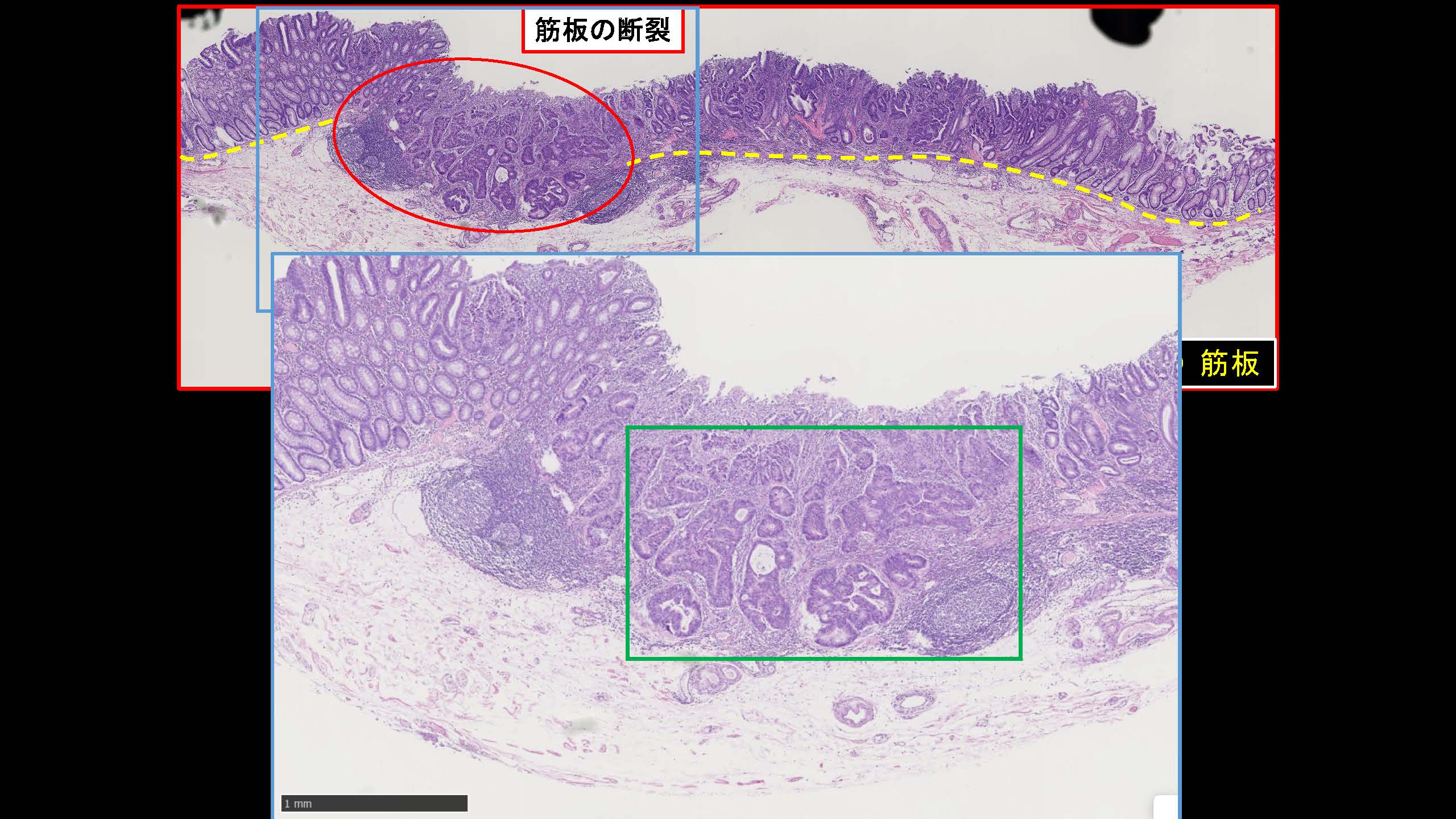 大腸052