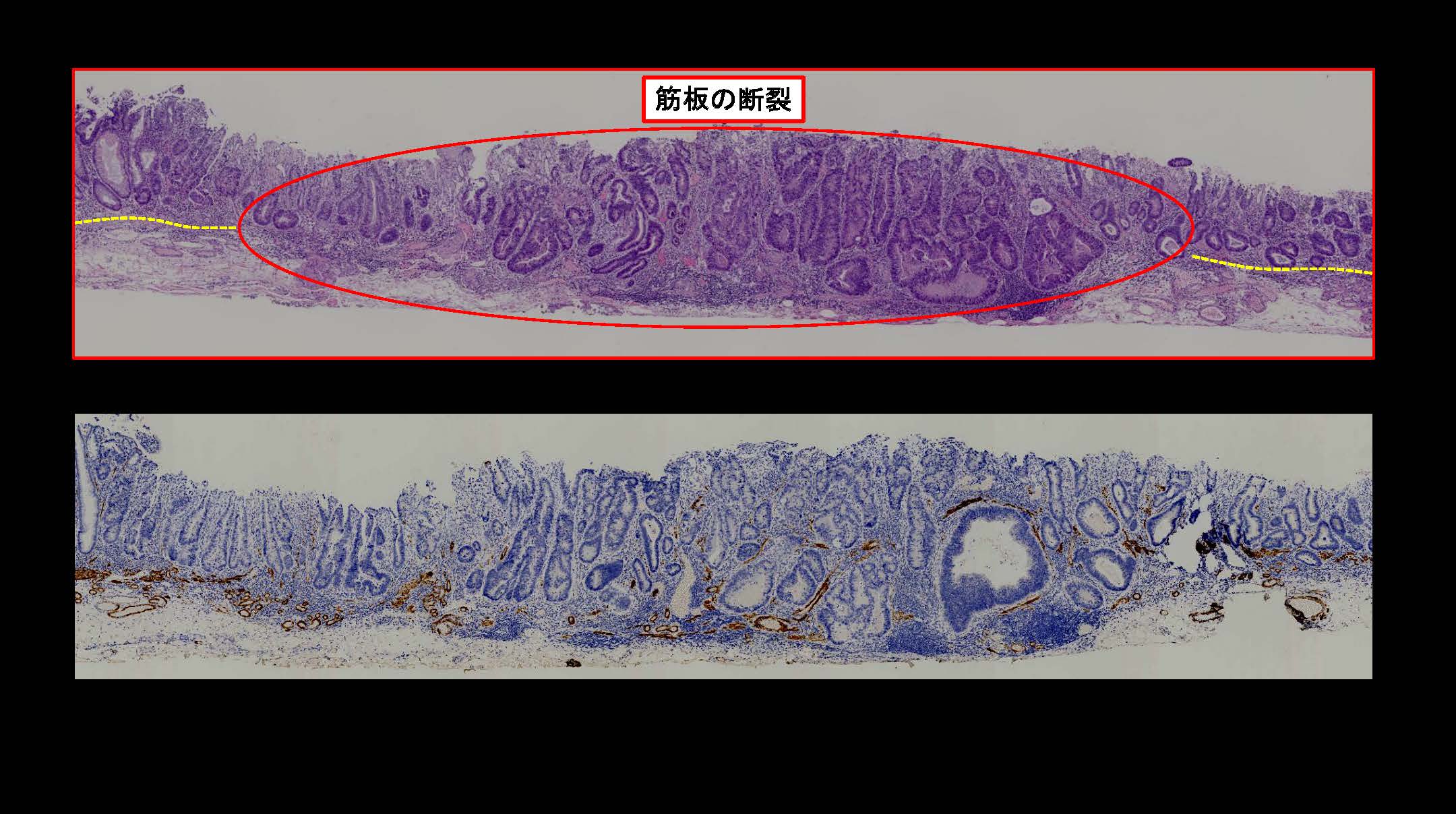 大腸062